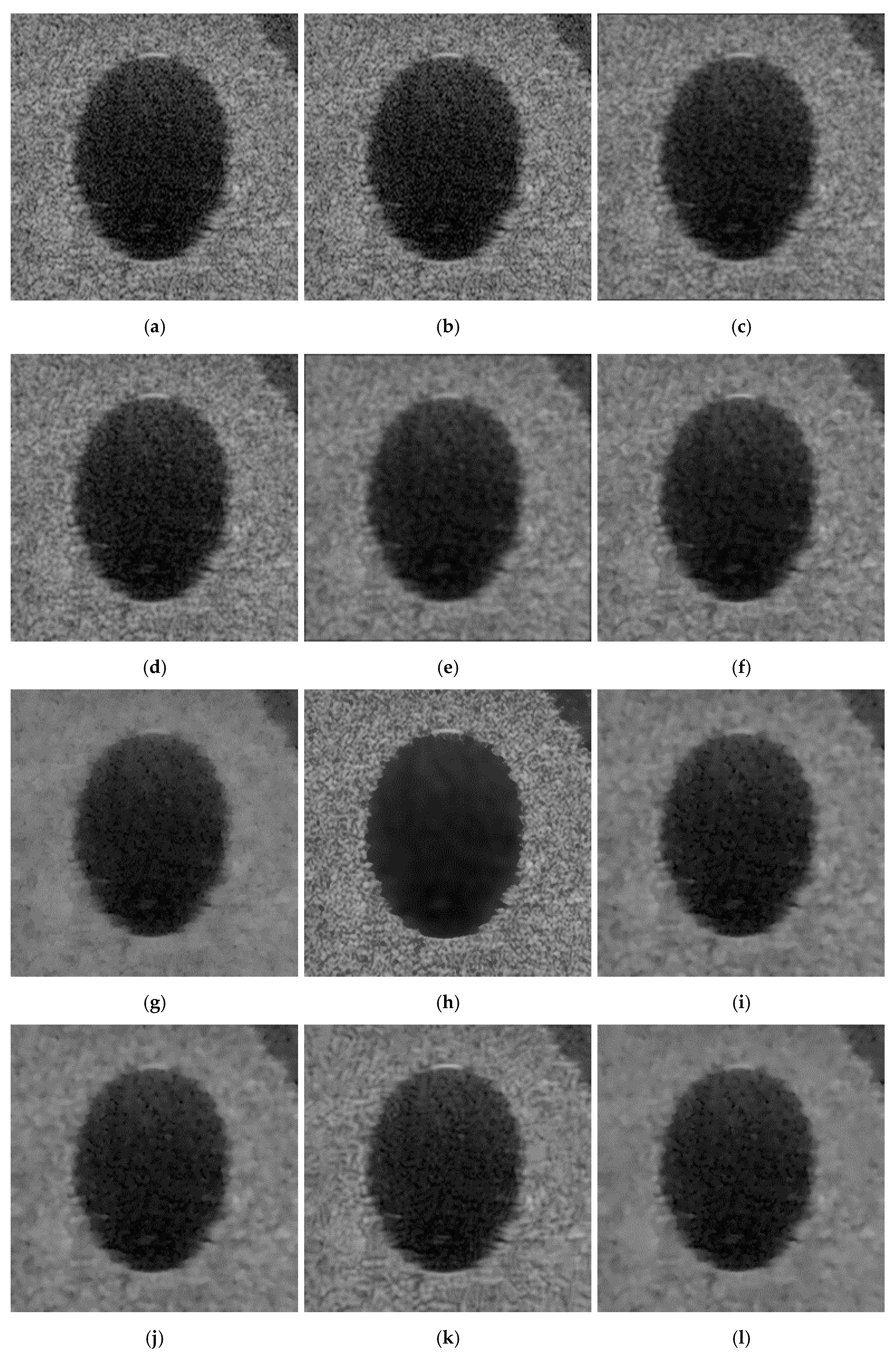 Symmetry Free FullText Despeckling Algorithm for Removing Speckle