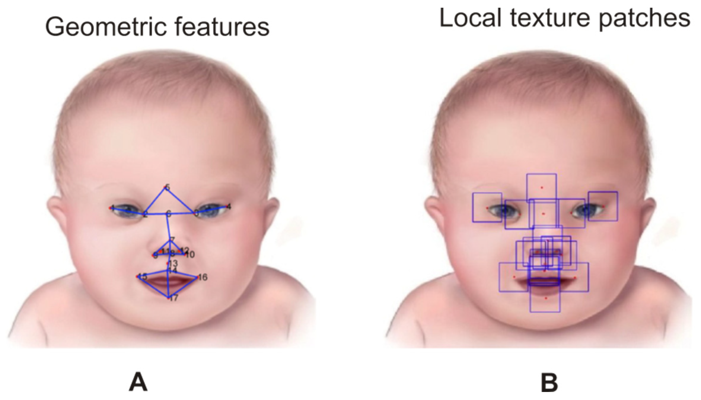 typical french facial features