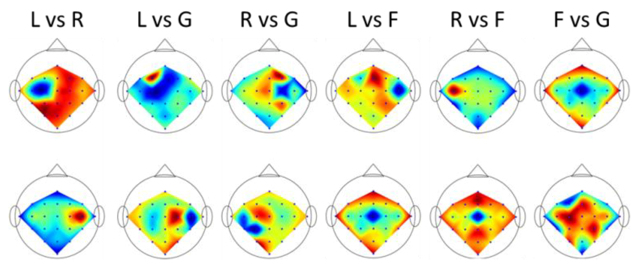 Symmetry Free Full Text Simultaneously Spatiospectral Pattern Learning And Contaminated Trial Pruning For Electroencephalography Based Brain Computer Interface Html