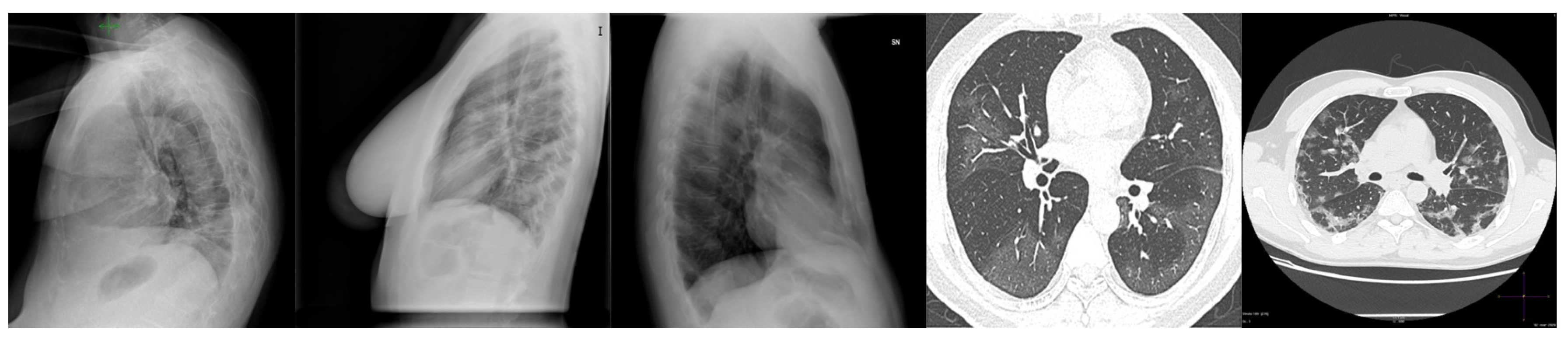 Symmetry 12 01530 g002