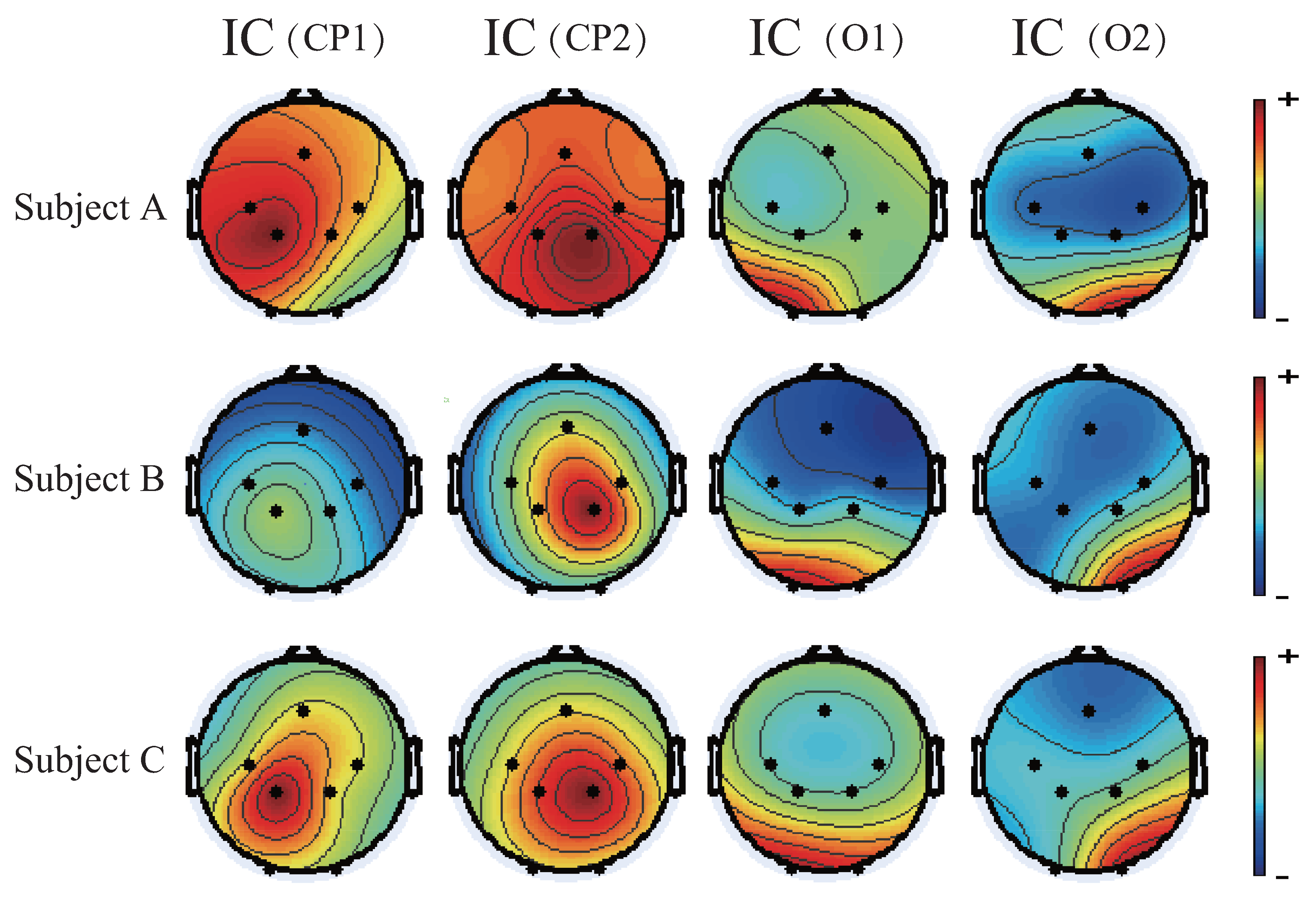 Symmetry Free Full Text Eeg Based Emg Estimation Of Shoulder Joint For The Power Augmentation System Of Upper Limbs Html