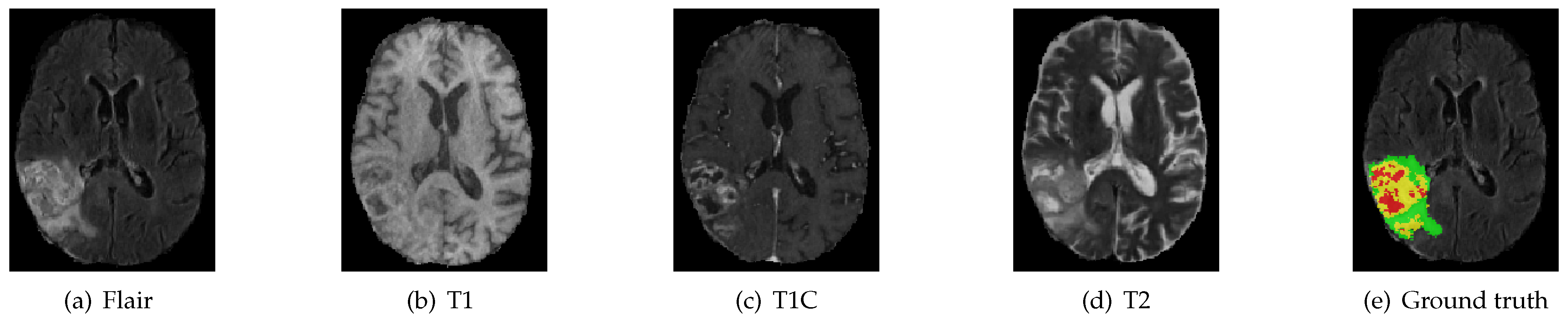 Symmetry 13 00320 g004