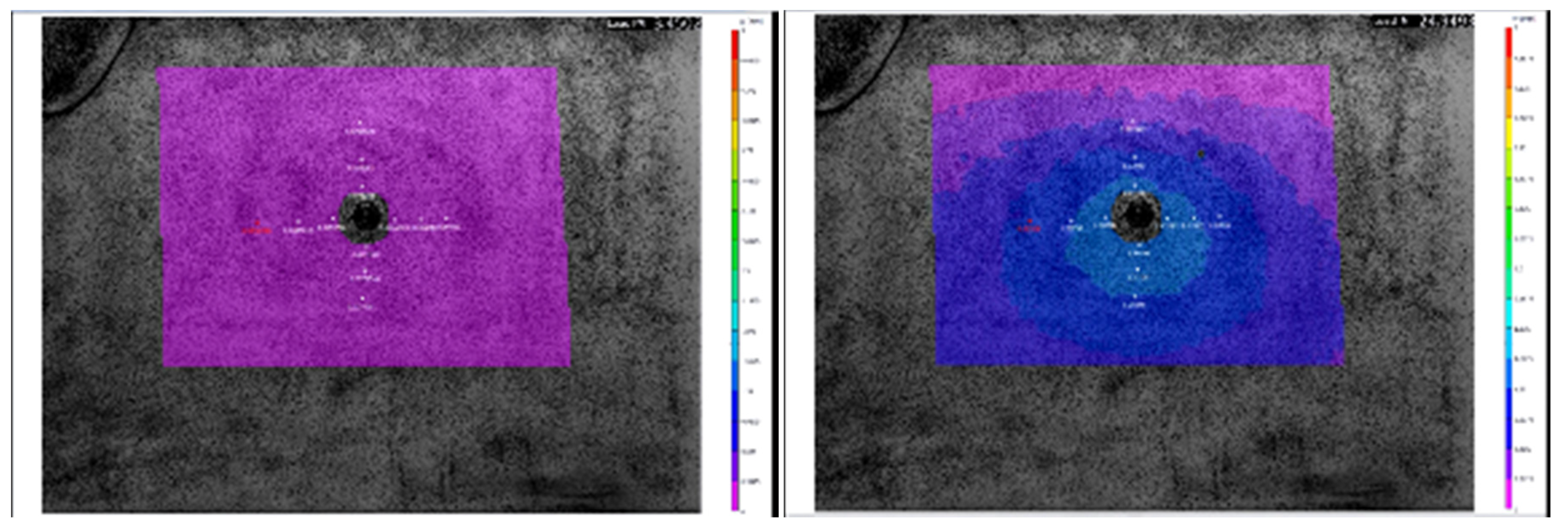 Symmetry 13 00383 g025