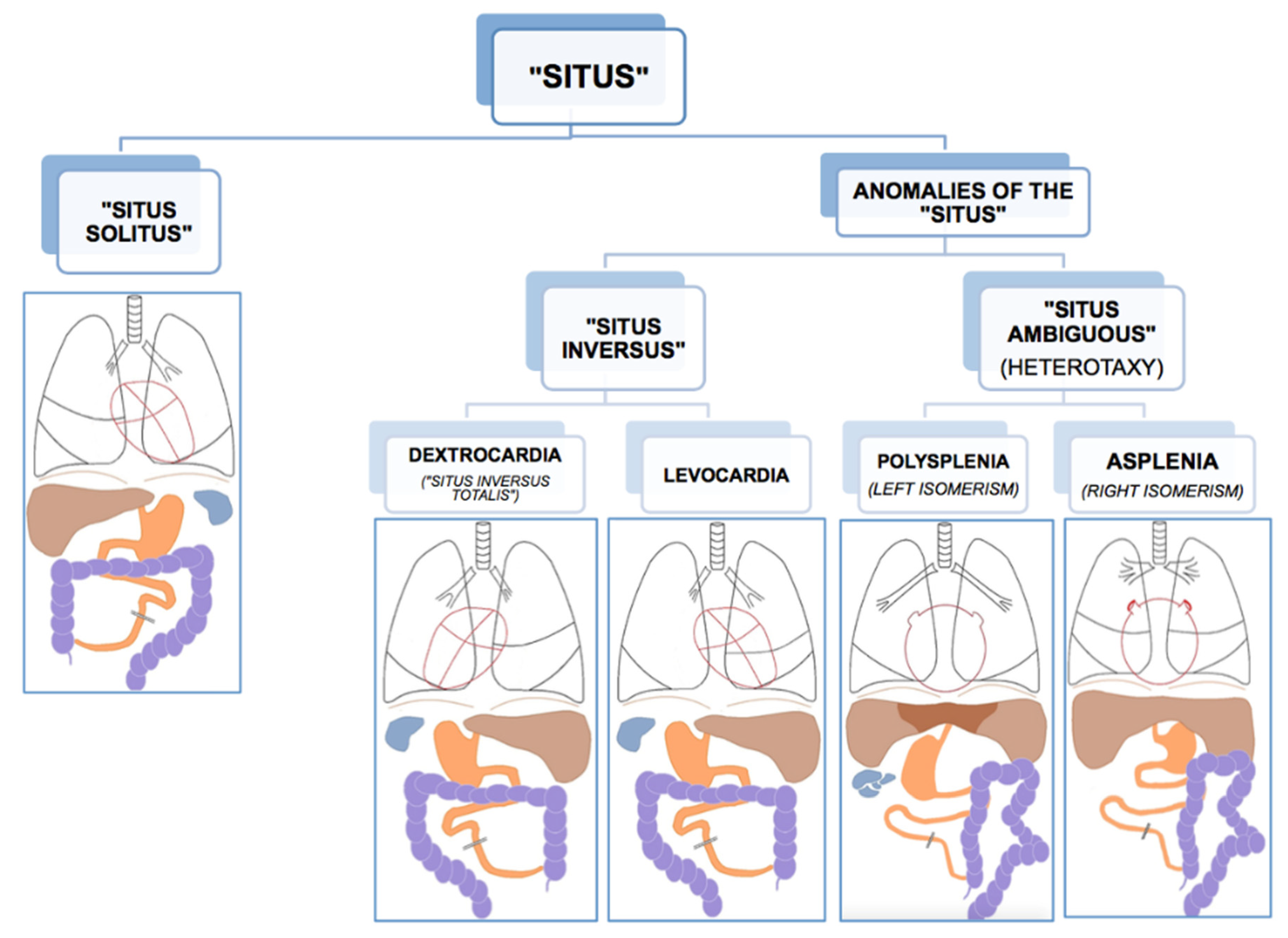 Symmetry Free Full Text Atypical Brain Asymmetry in Human Situs Symmetry Free Full Text Atypical Brain Asymmetry in Human Situs