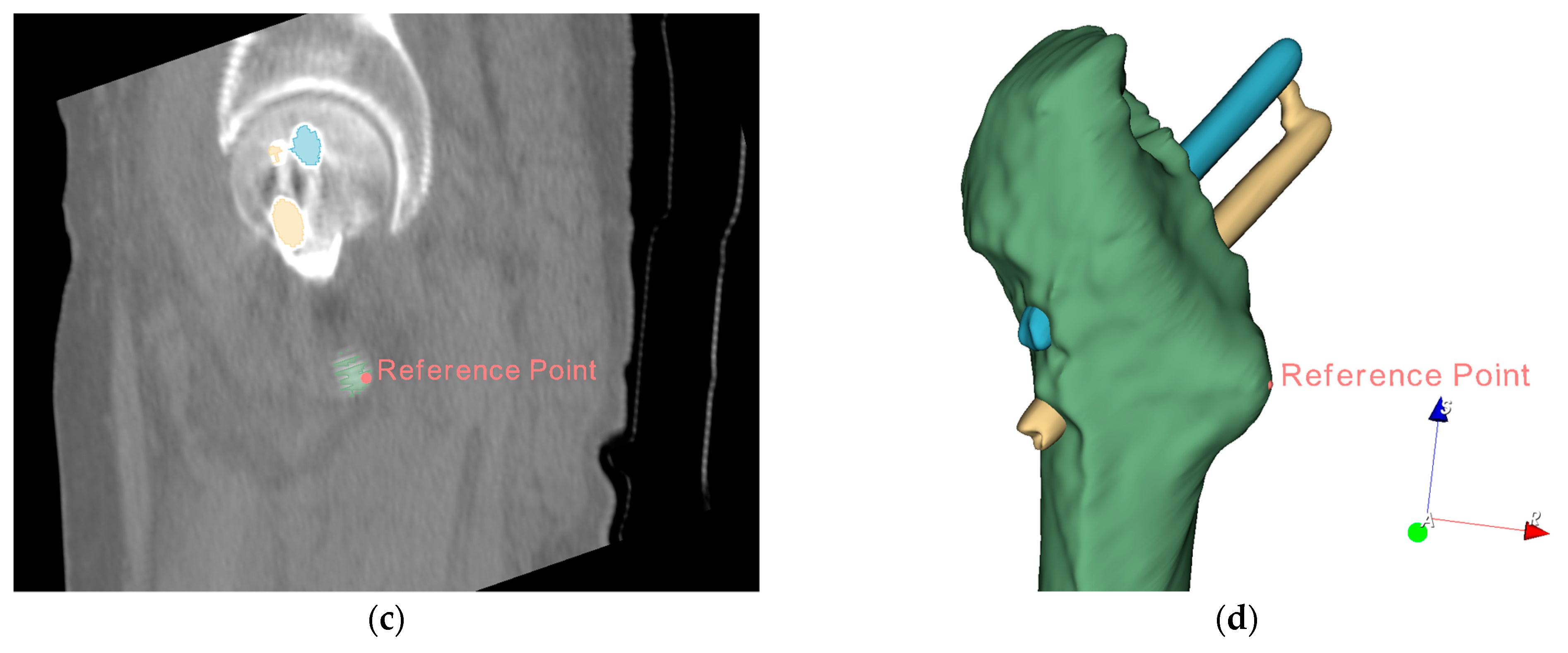 Symmetry 13 00747 g013b