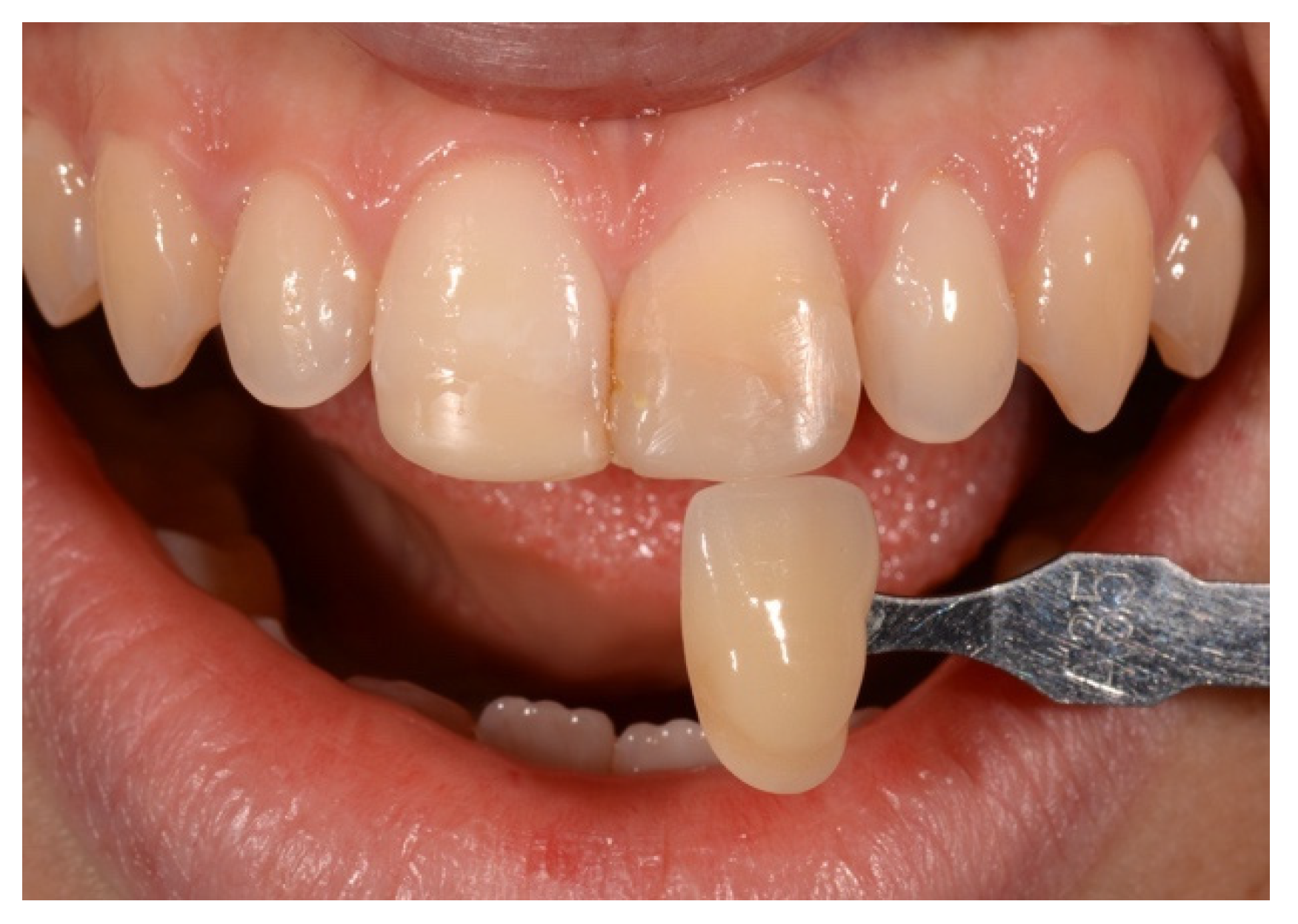 Symmetry 13 00797 g007 Symmetry 13 00797 g007