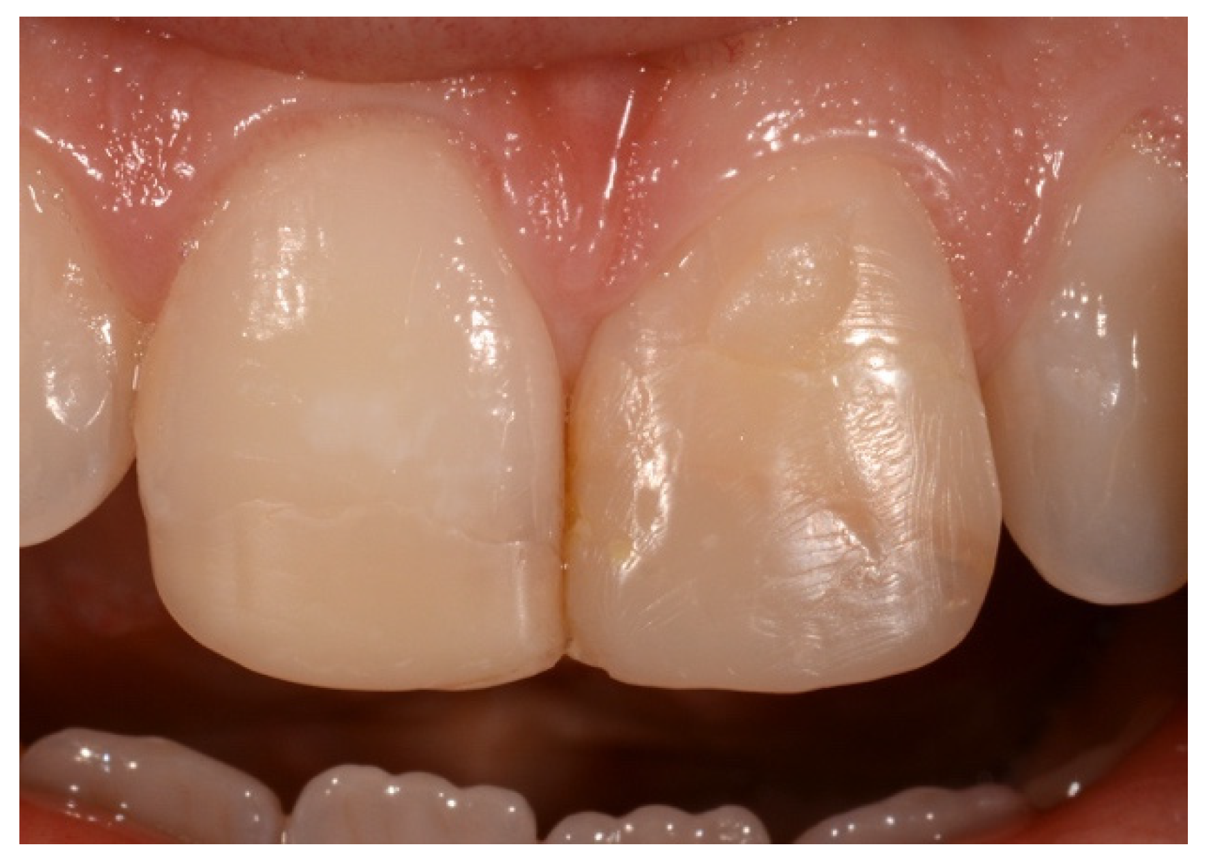 Symmetry 13 00797 g008 Symmetry 13 00797 g008