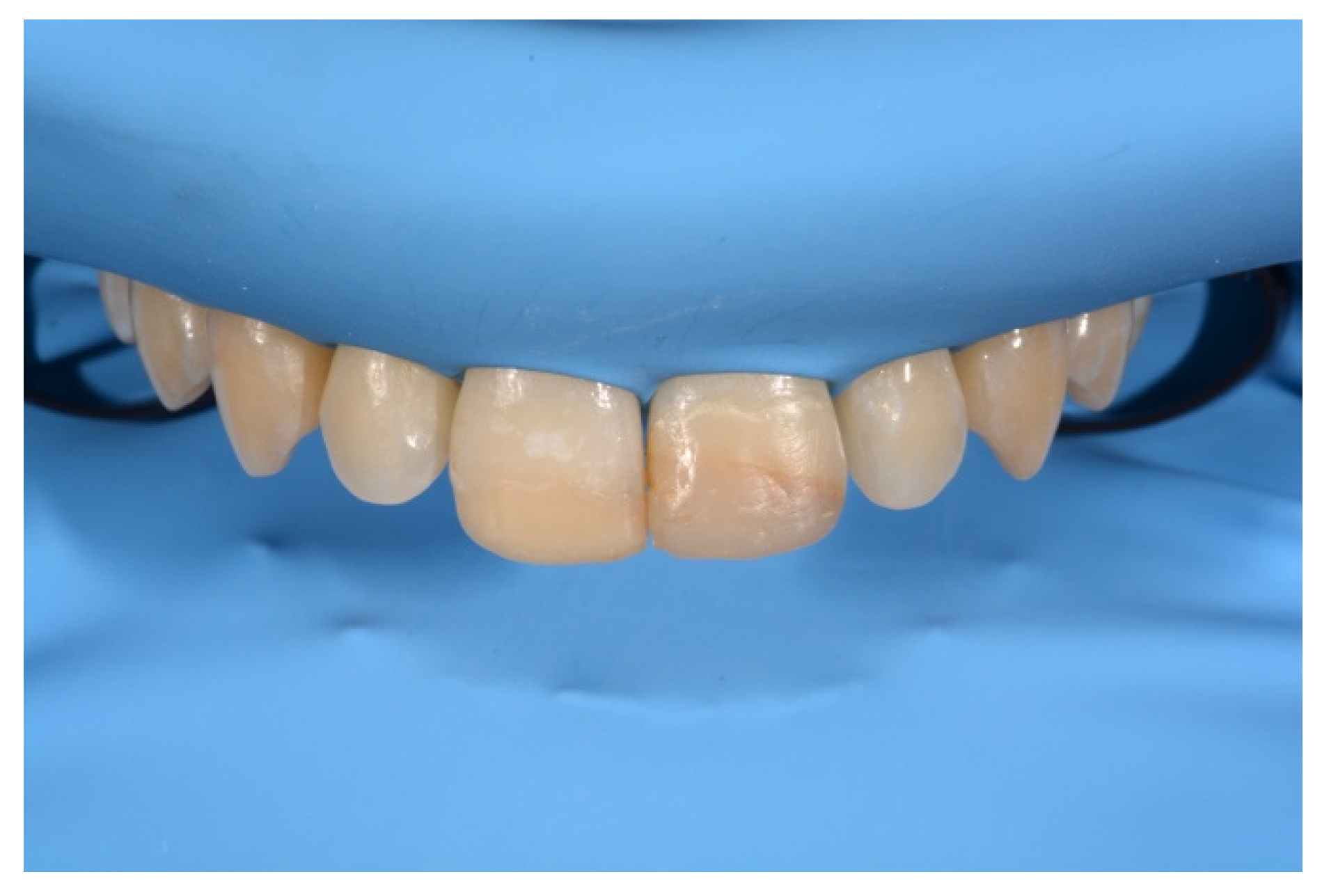 Symmetry 13 00797 g010 Symmetry 13 00797 g010