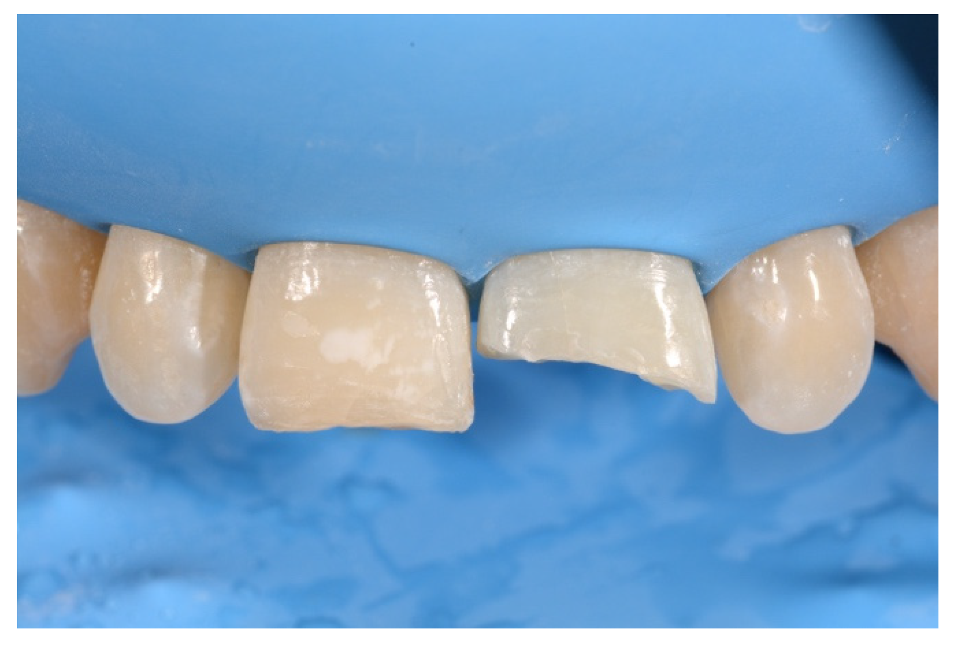 Symmetry 13 00797 g011 Symmetry 13 00797 g011