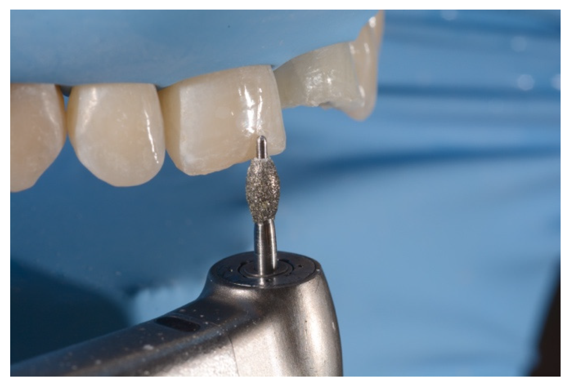 Symmetry 13 00797 g012 Symmetry 13 00797 g012