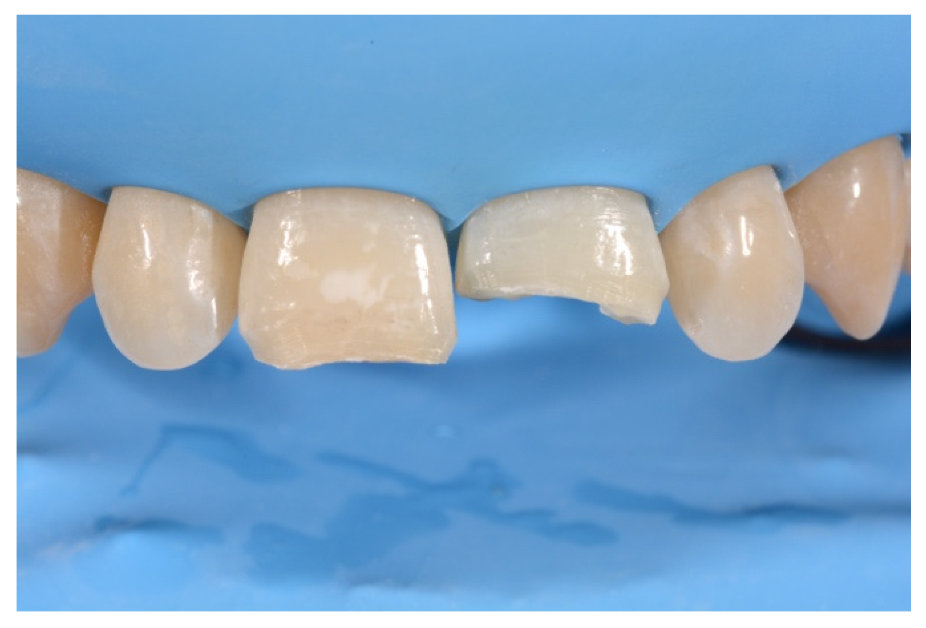 Symmetry 13 00797 g013 Symmetry 13 00797 g013