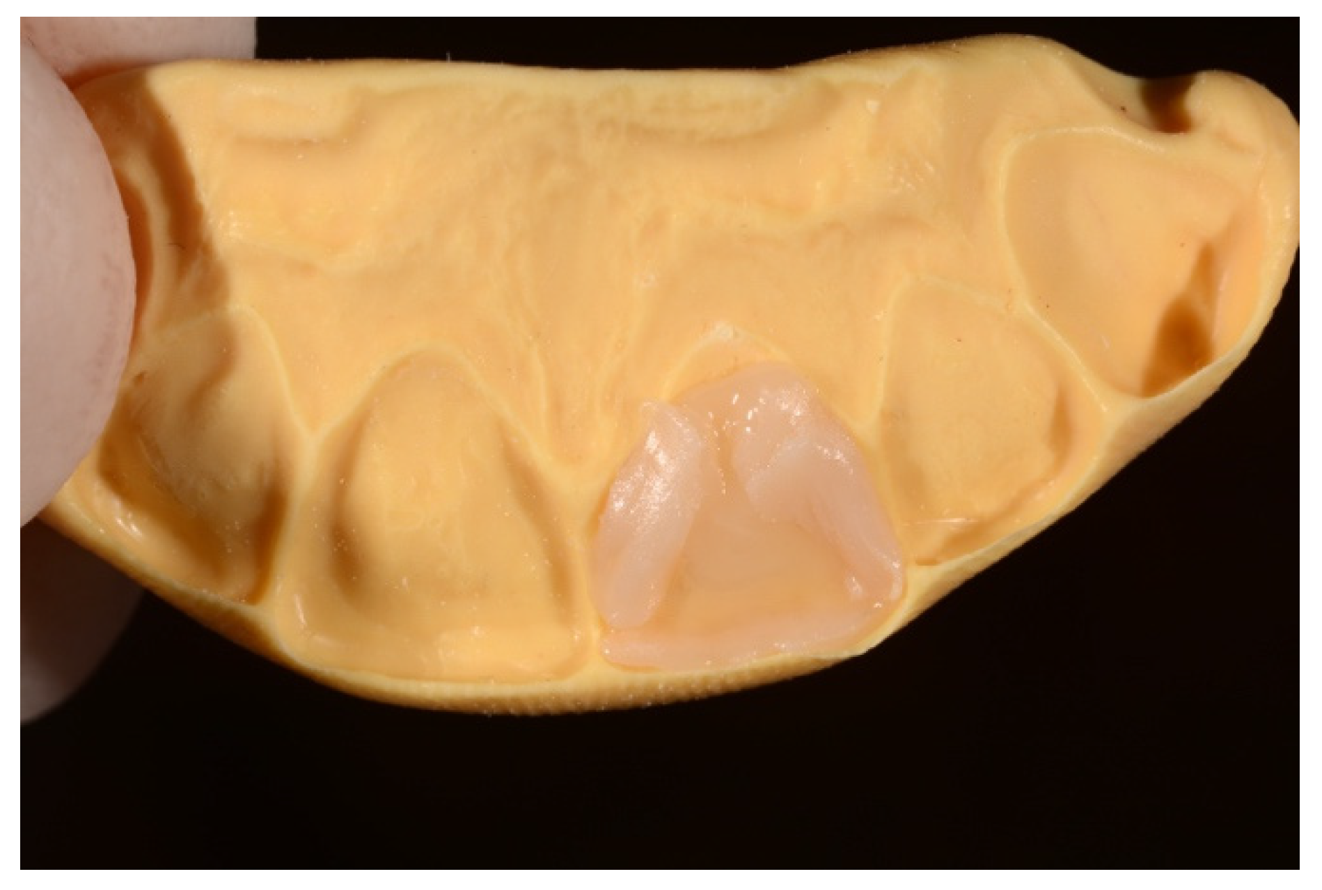 Symmetry 13 00797 g014 Symmetry 13 00797 g014