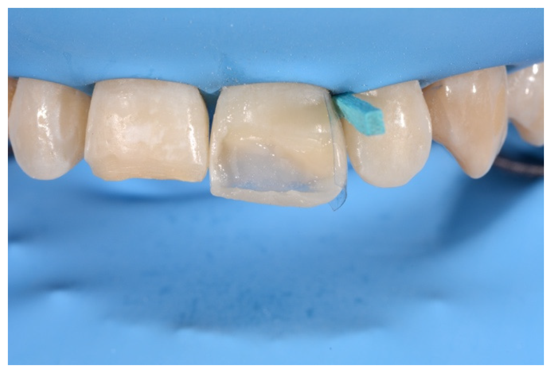 Symmetry 13 00797 g015 Symmetry 13 00797 g015