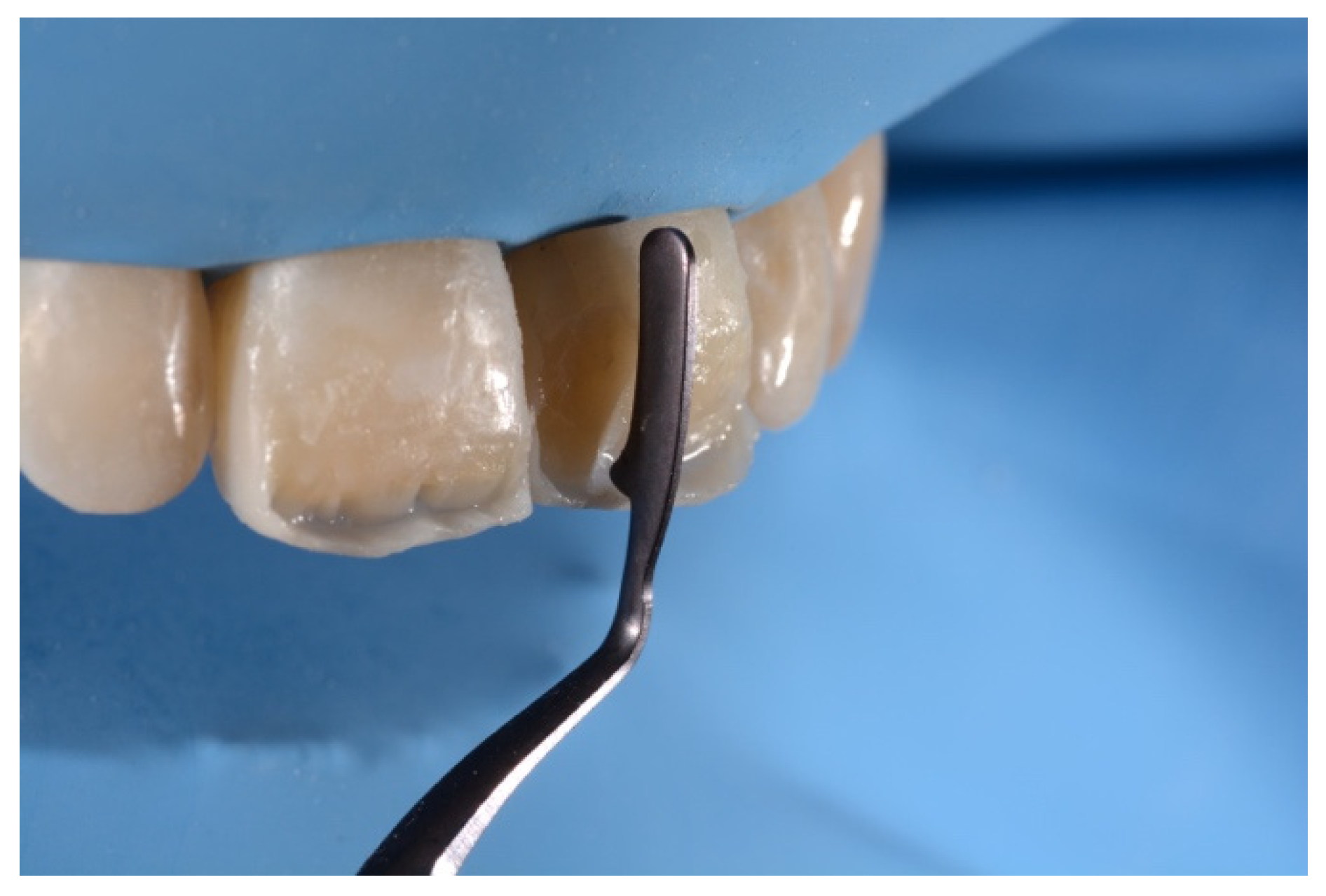 Symmetry 13 00797 g018 Symmetry 13 00797 g018