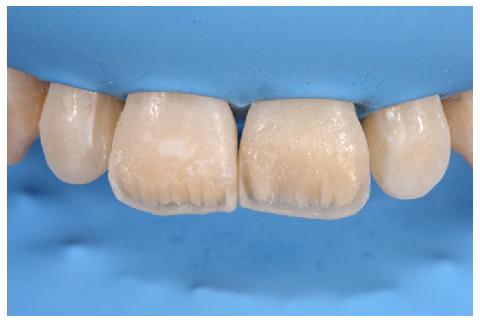 Symmetry 13 00797 g019 Symmetry 13 00797 g019