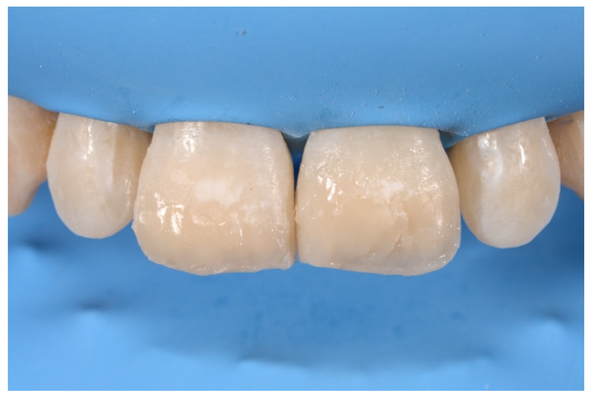 Symmetry 13 00797 g020 Symmetry 13 00797 g020