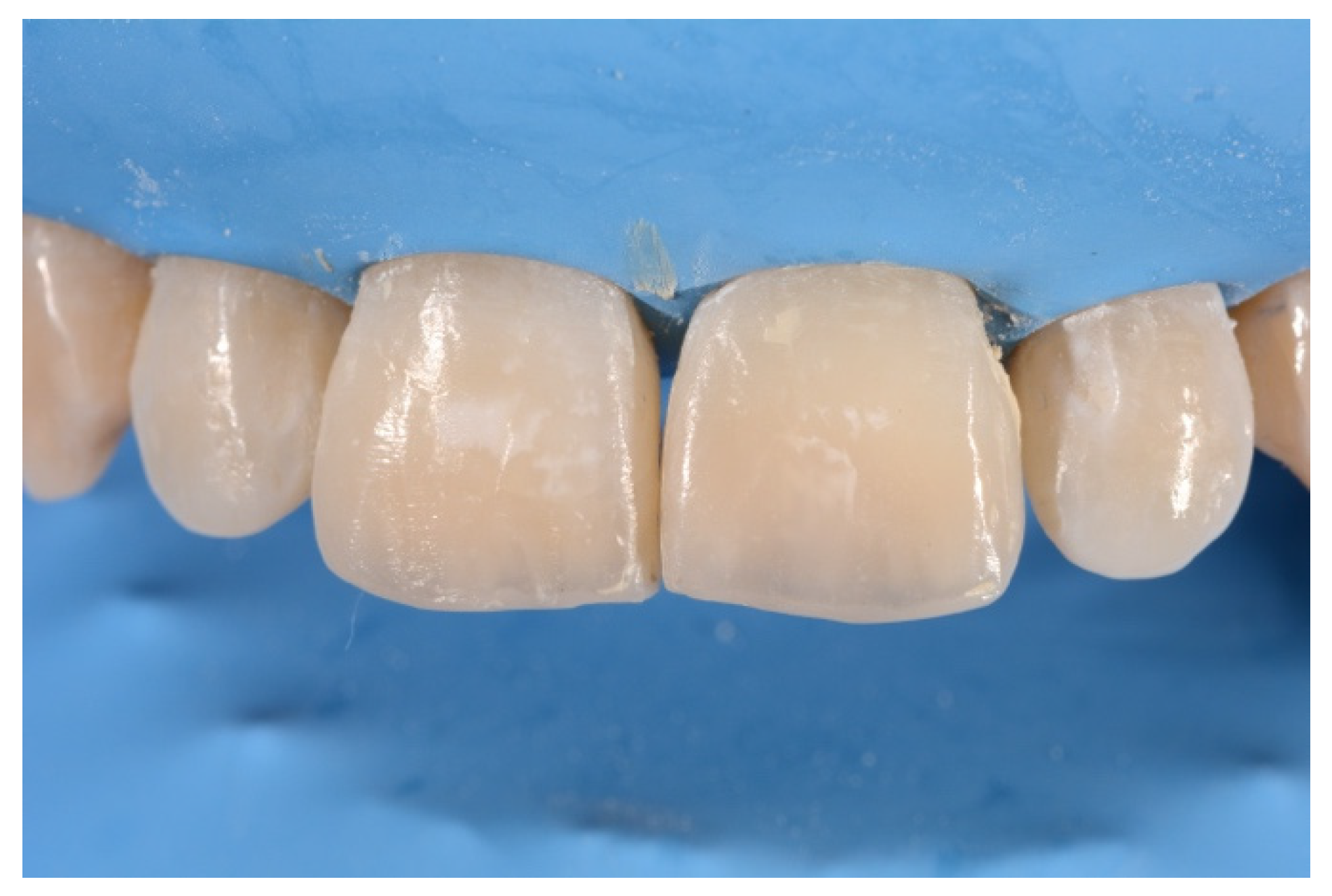 Symmetry 13 00797 g022 Symmetry 13 00797 g022