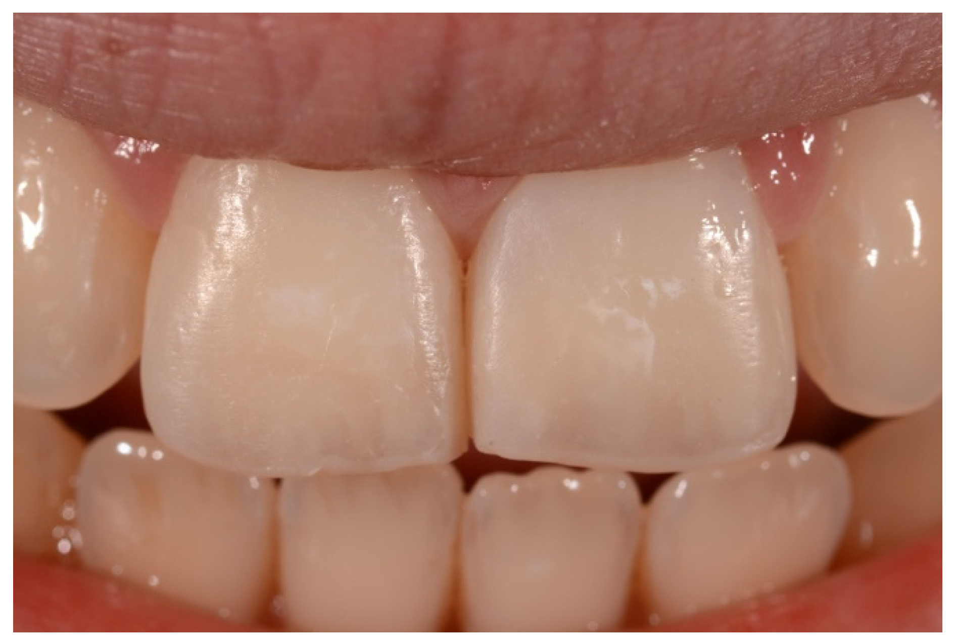 Symmetry 13 00797 g023 Symmetry 13 00797 g023