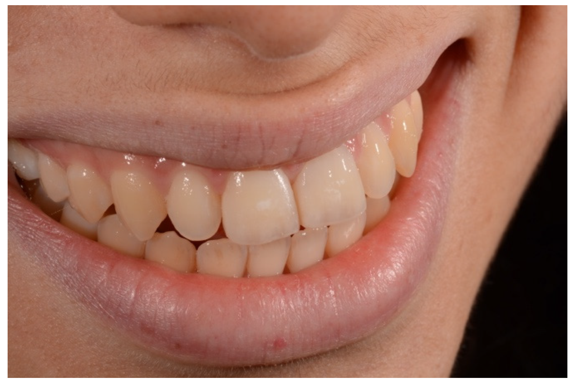 Symmetry 13 00797 g024 Symmetry 13 00797 g024