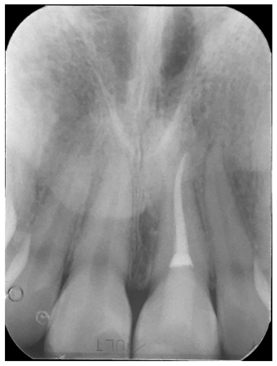 Symmetry 13 00797 g026 Symmetry 13 00797 g026