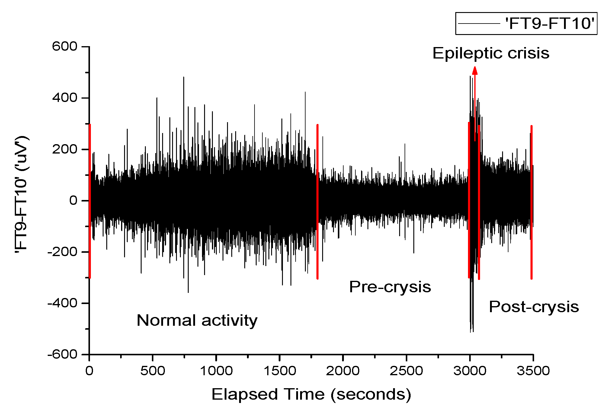 Novel Approach for EEG Signal Analysis in a Multifractal