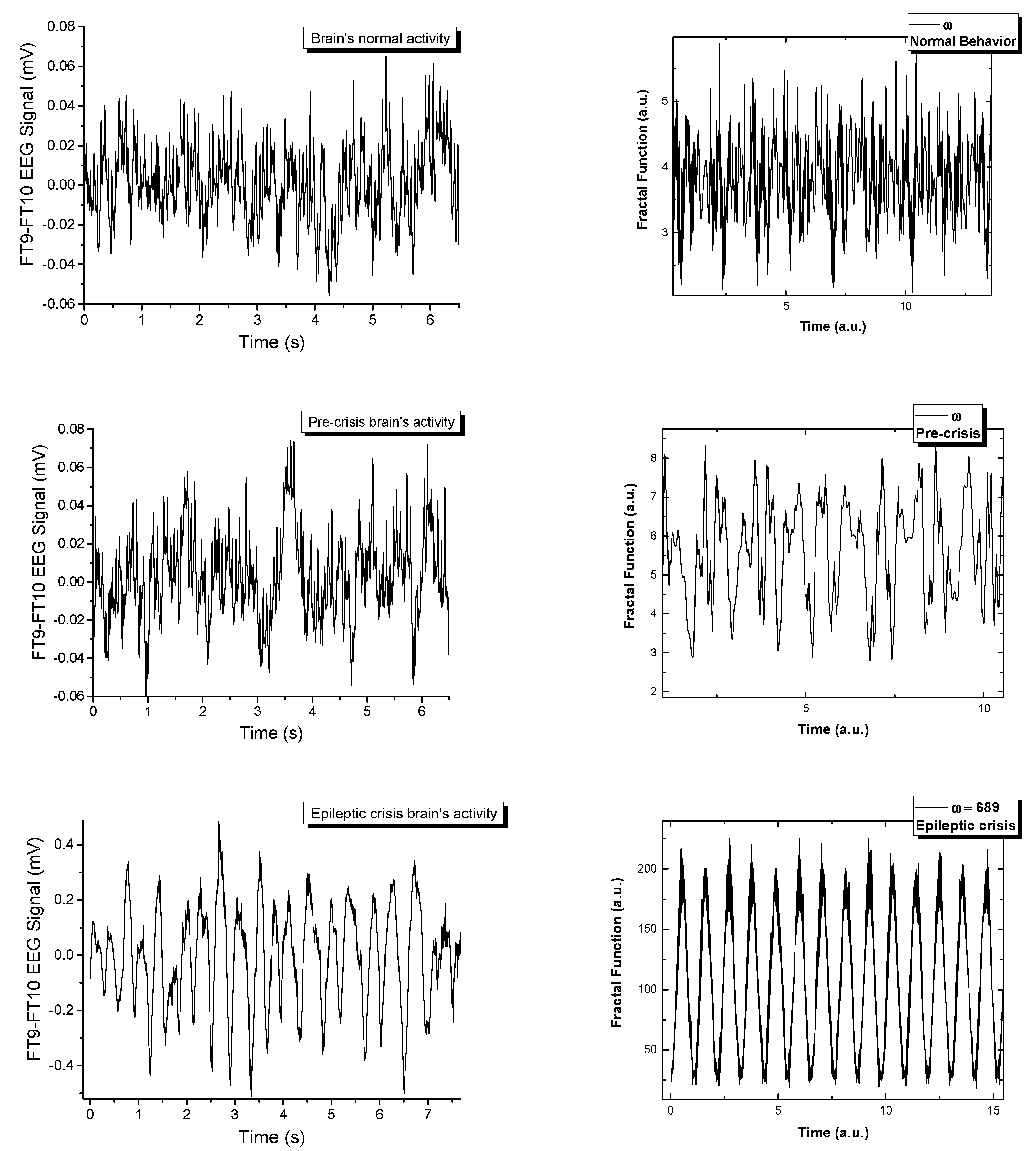 eeg data eeg data