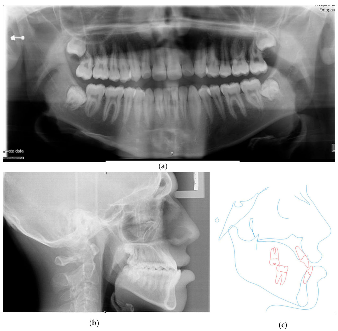 Symmetry 13 01150 g003