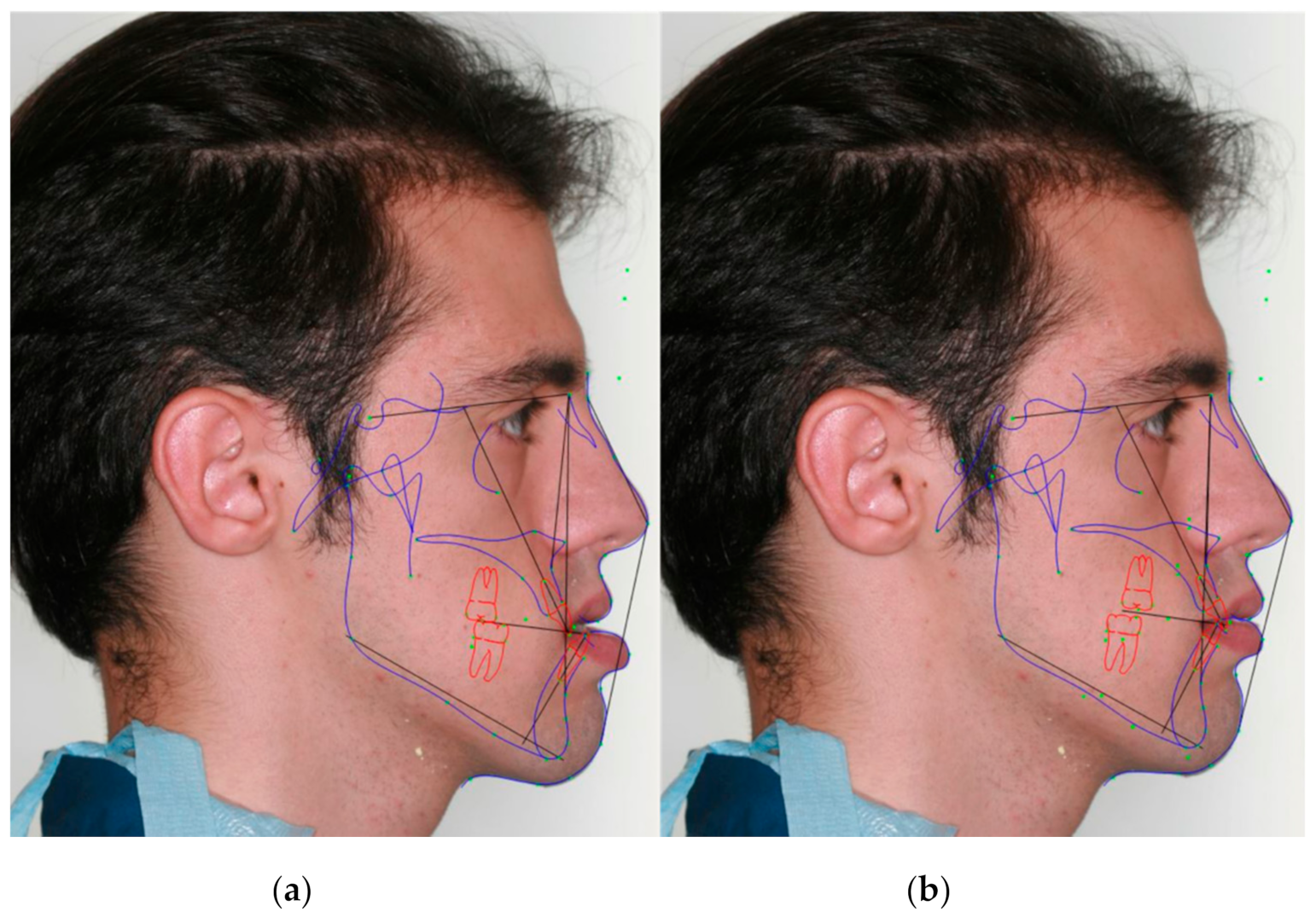 Symmetry 13 01150 g005
