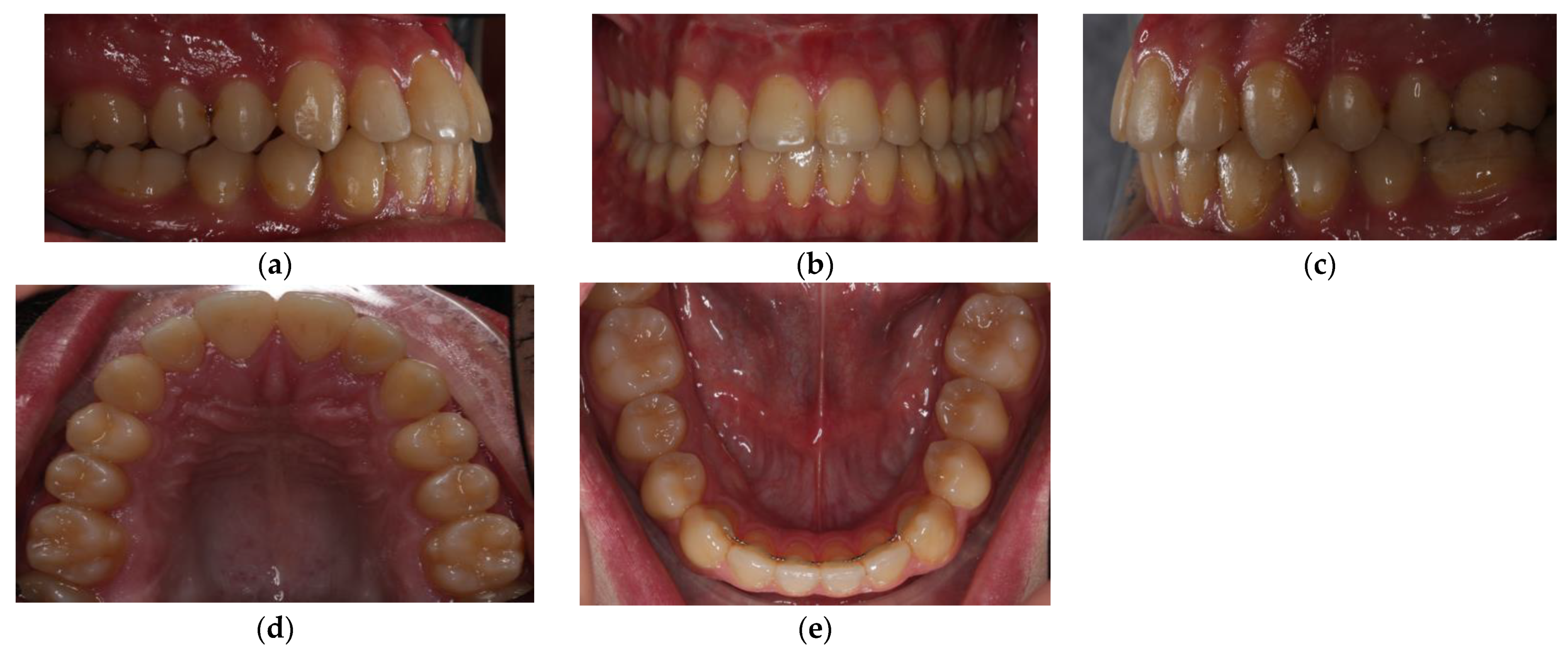 Symmetry 13 01150 g006