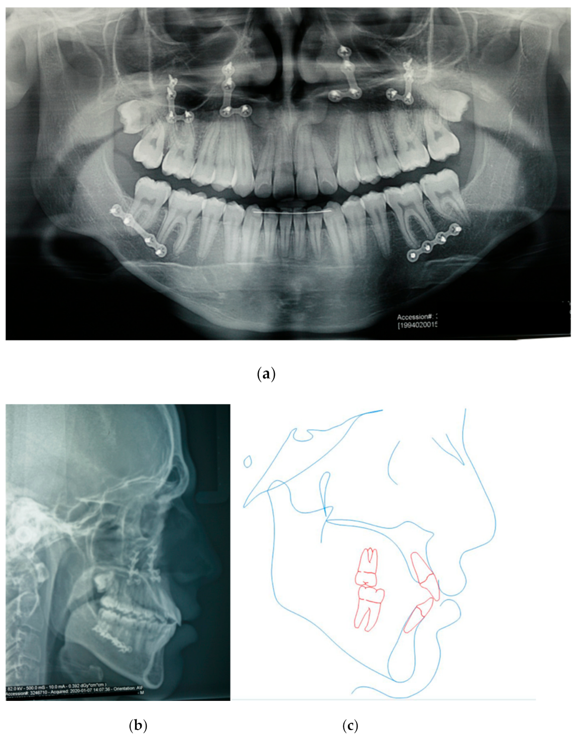 Symmetry 13 01150 g008