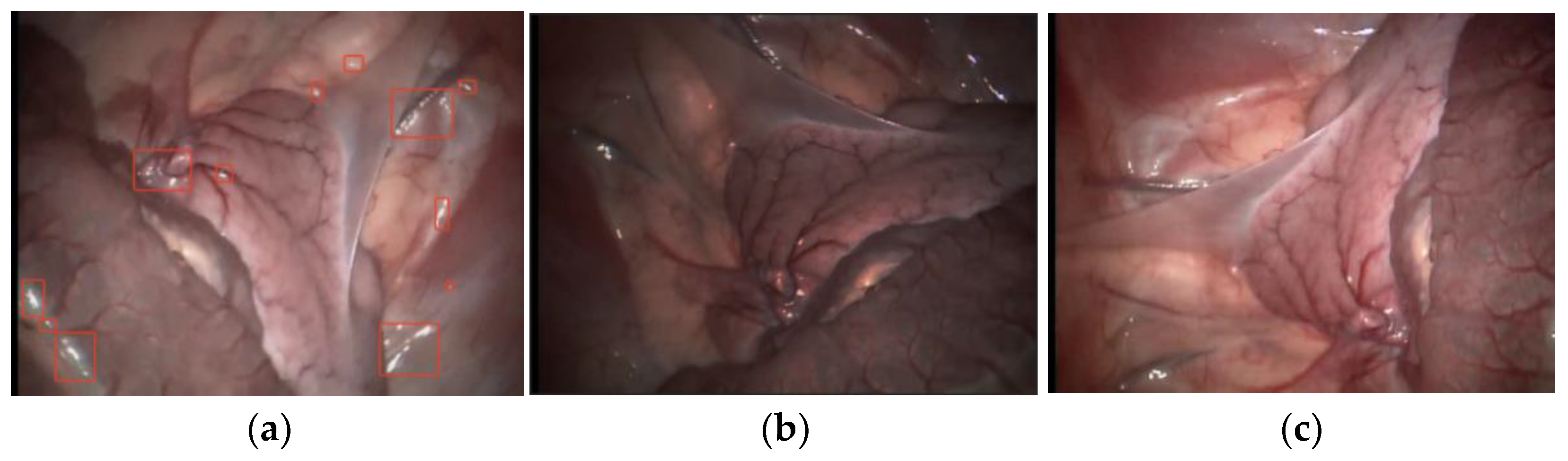 Symmetry 14 00185 g002 550