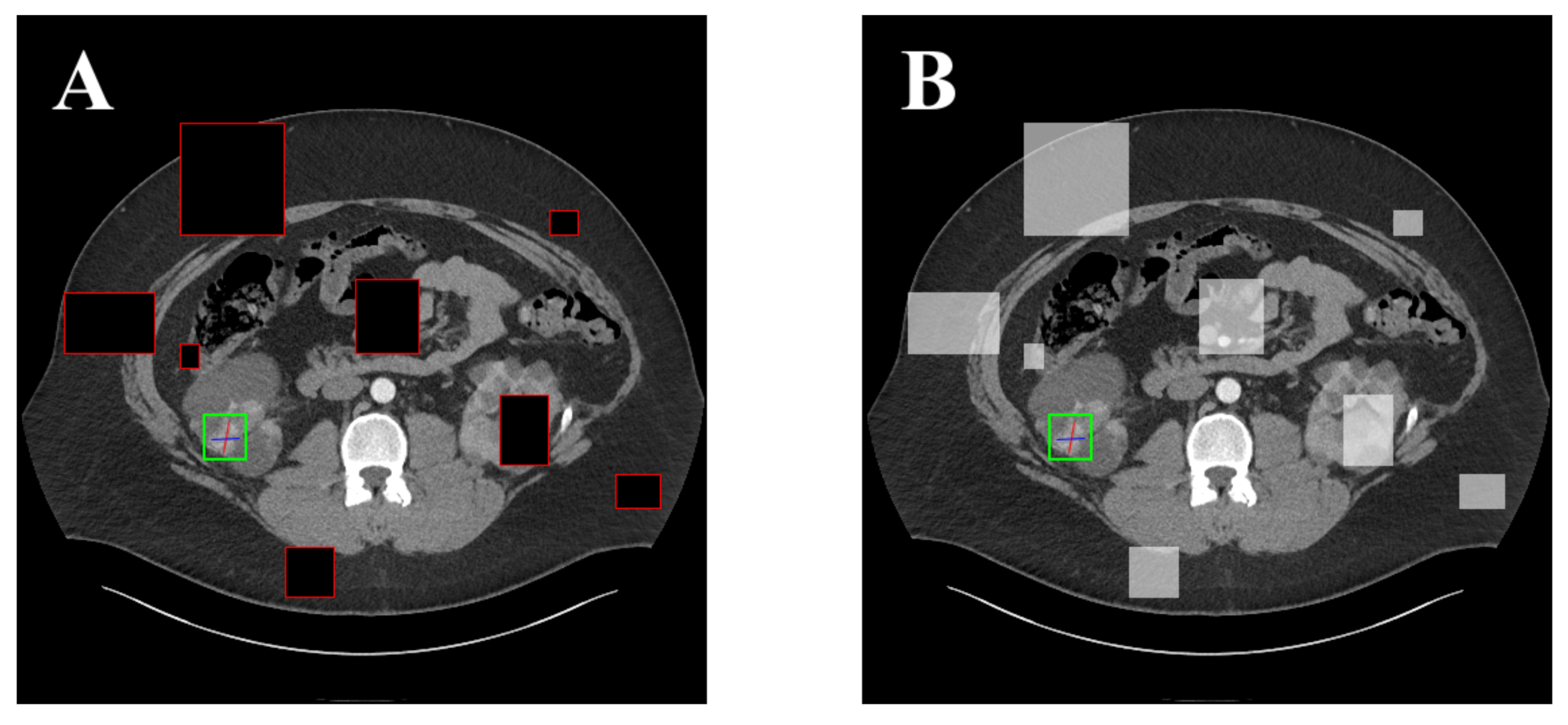 Symmetry 14 00234 g002 550