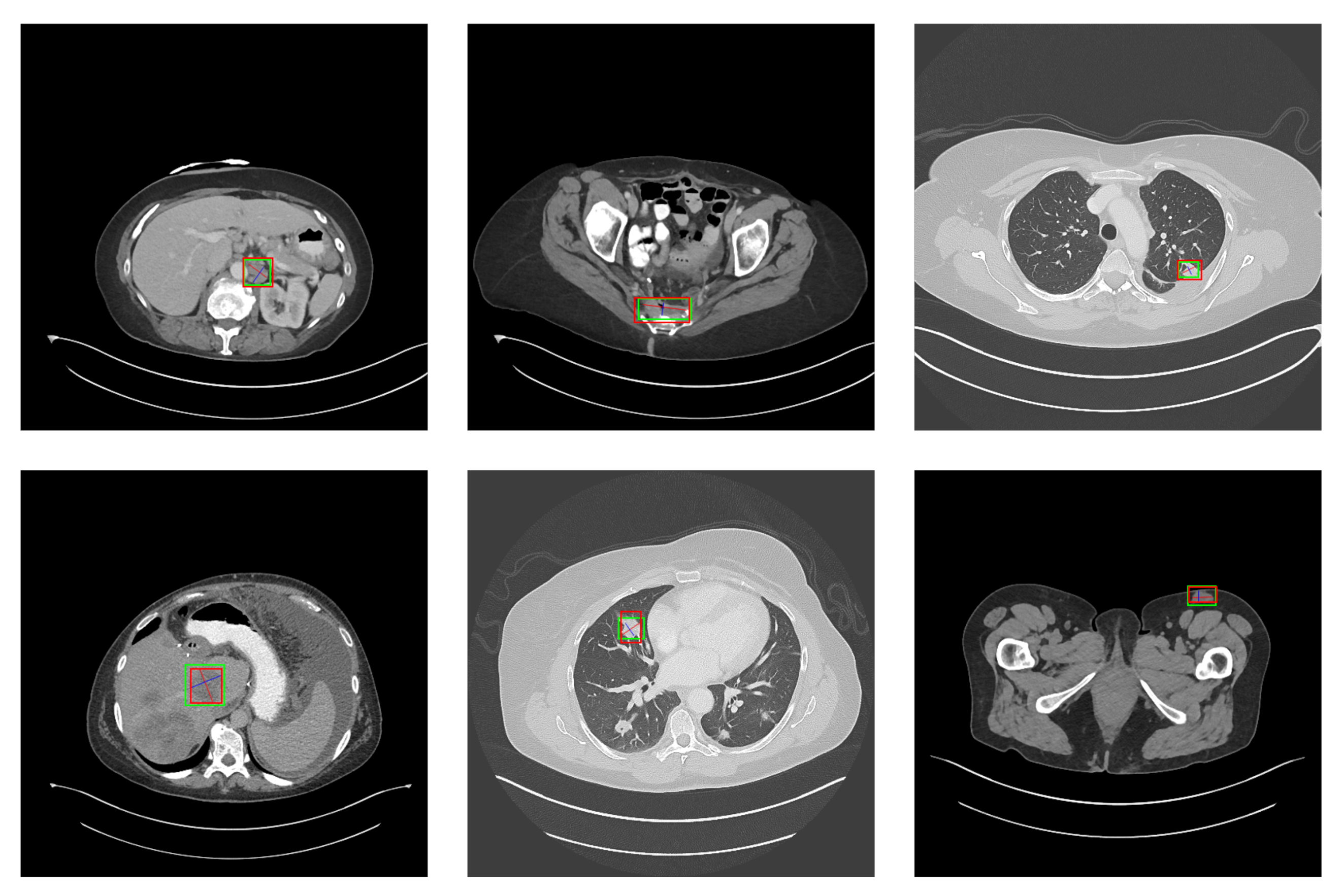 Symmetry 14 00234 g011 550
