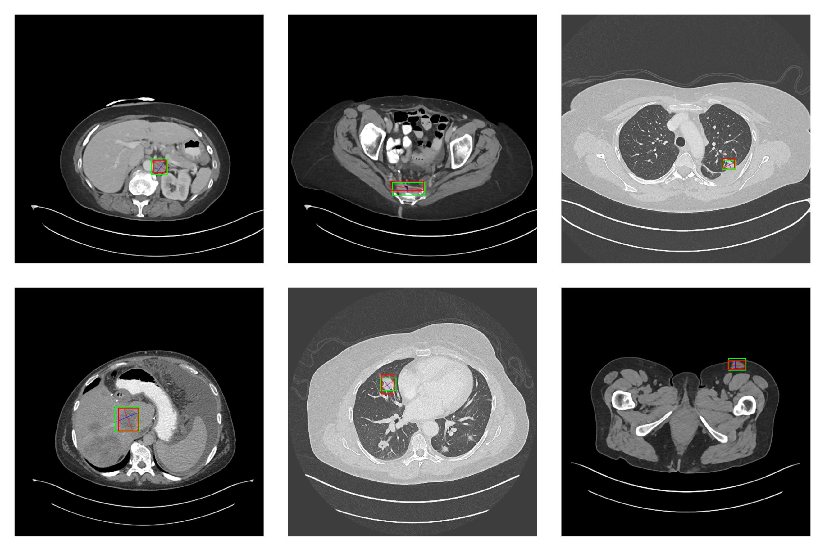 Symmetry 14 00234 g013 550