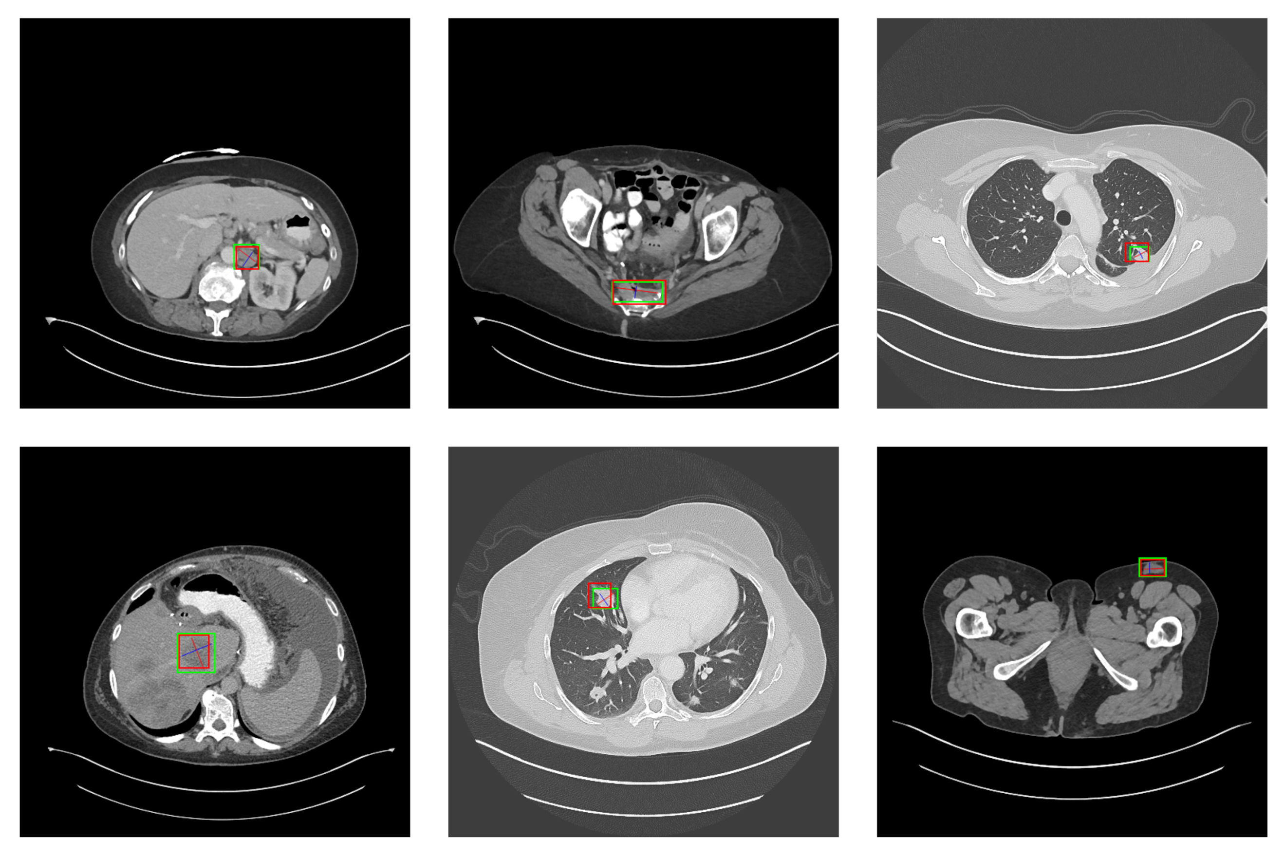 Symmetry 14 00234 g014 550