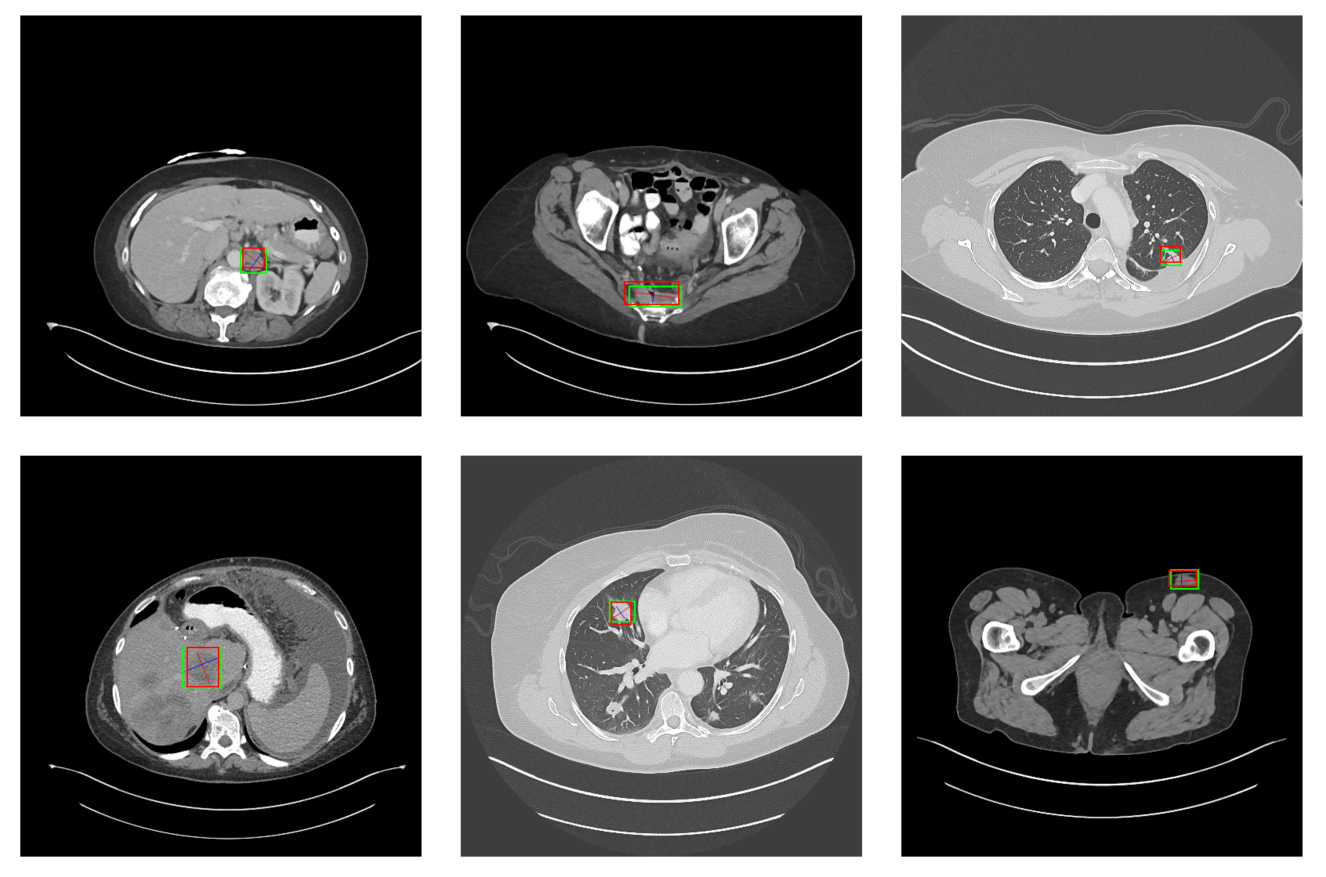 Symmetry 14 00234 g016 550
