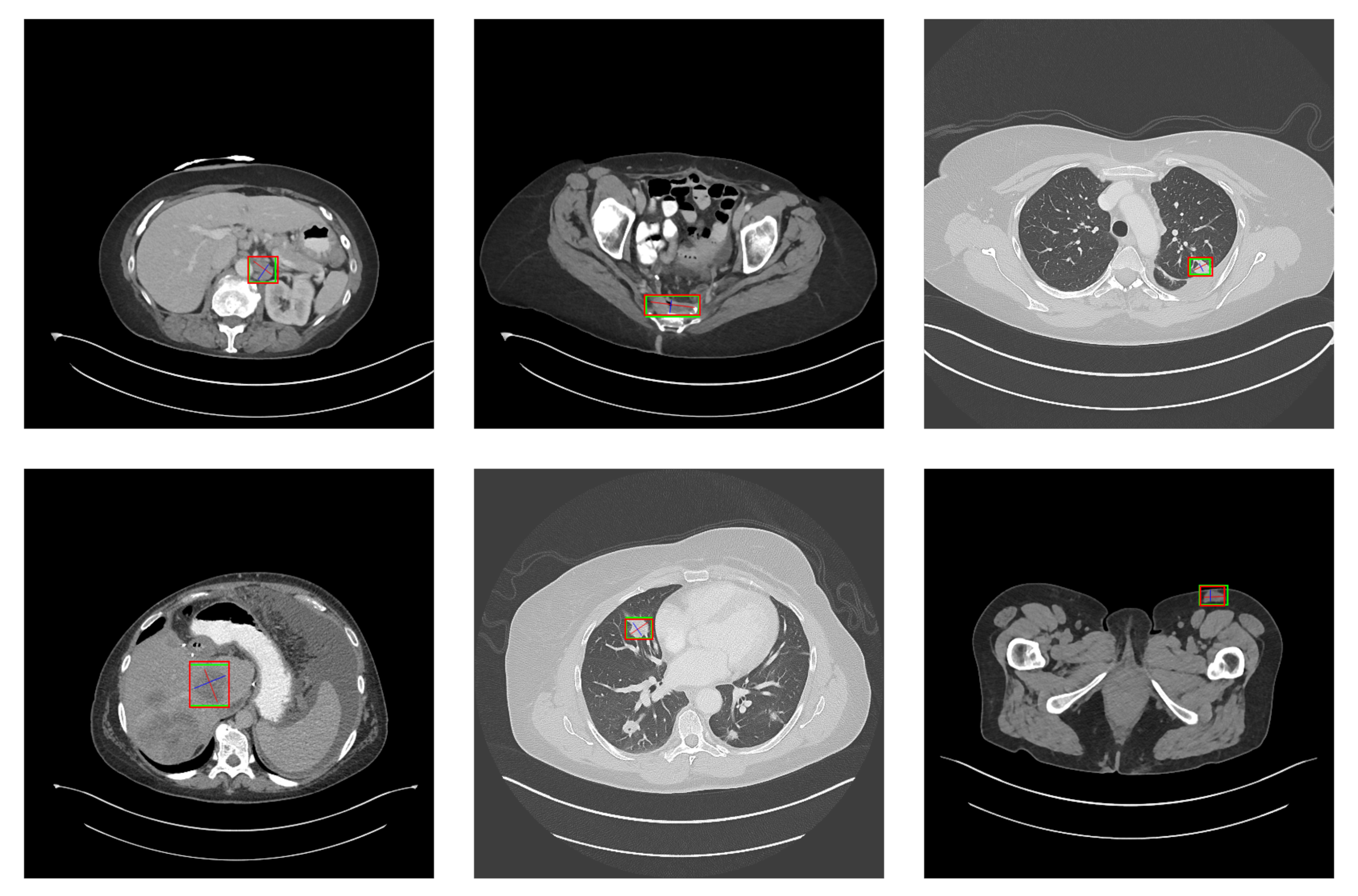 Symmetry 14 00234 g018 550