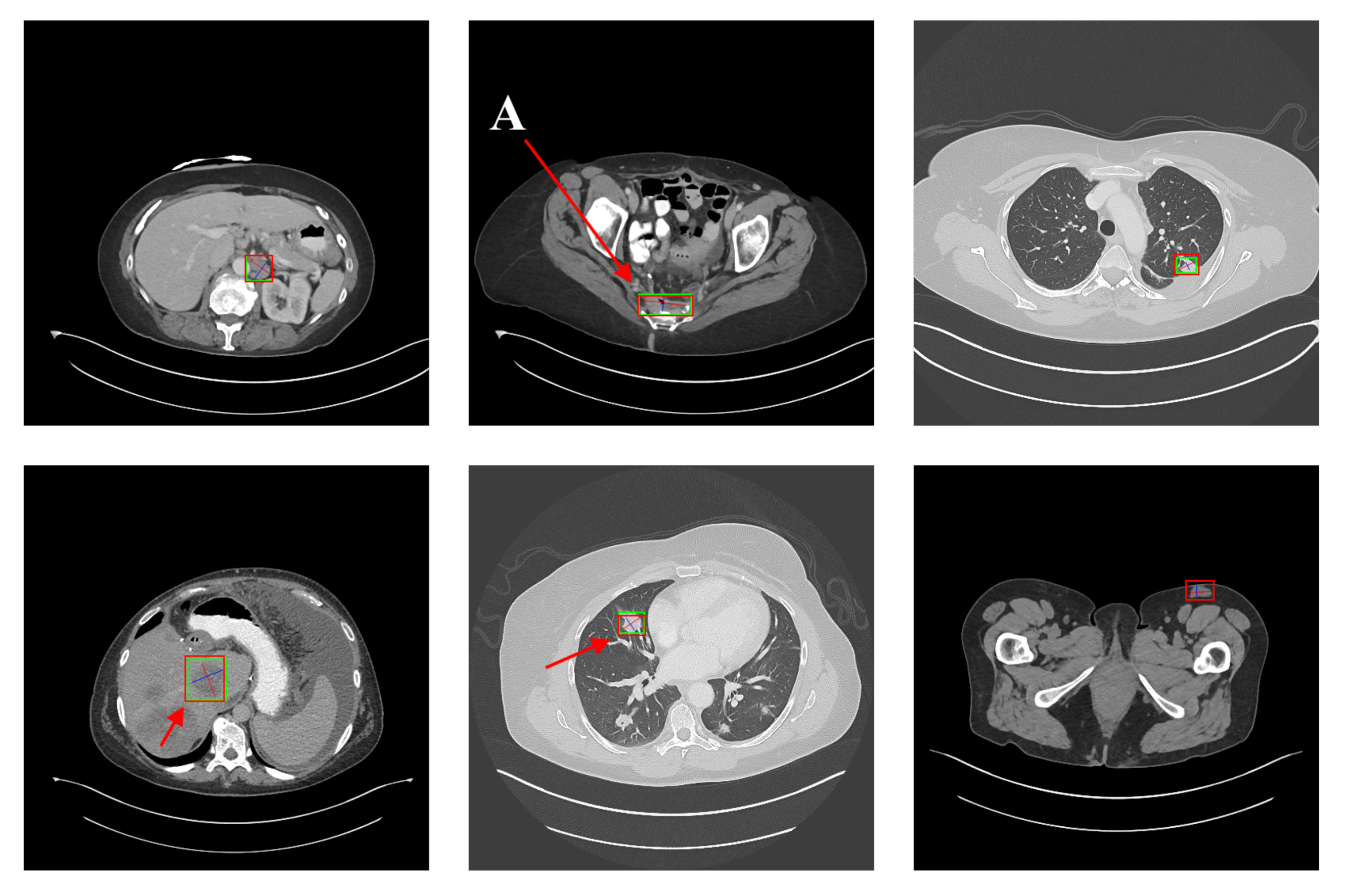 Symmetry 14 00234 g019 550