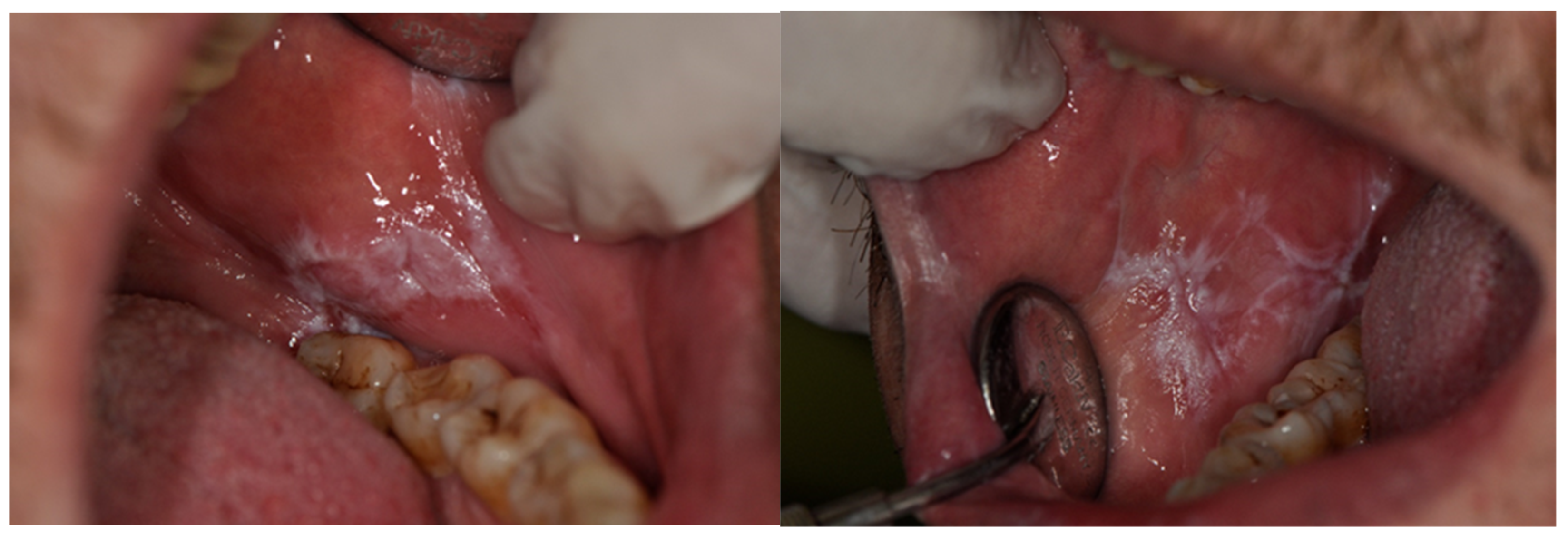 Symmetry 14 00307 g002 550