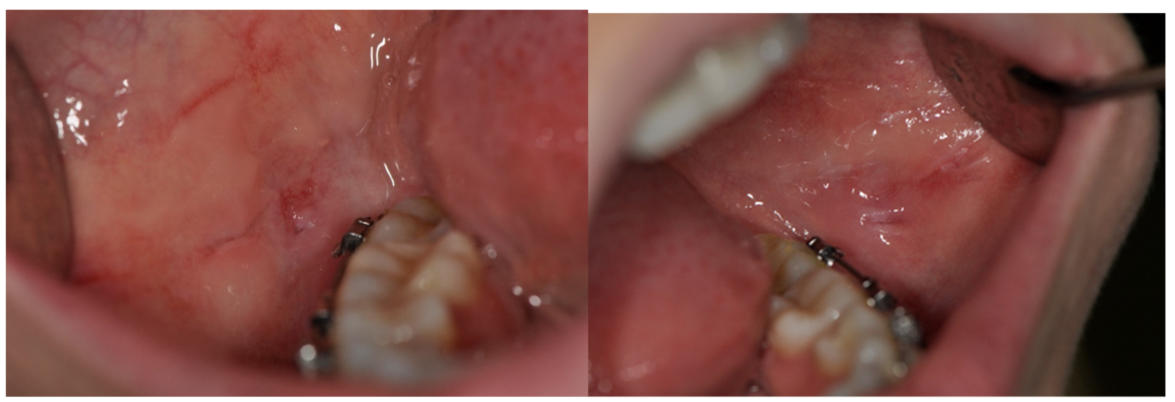 Symmetry 14 00307 g006 550