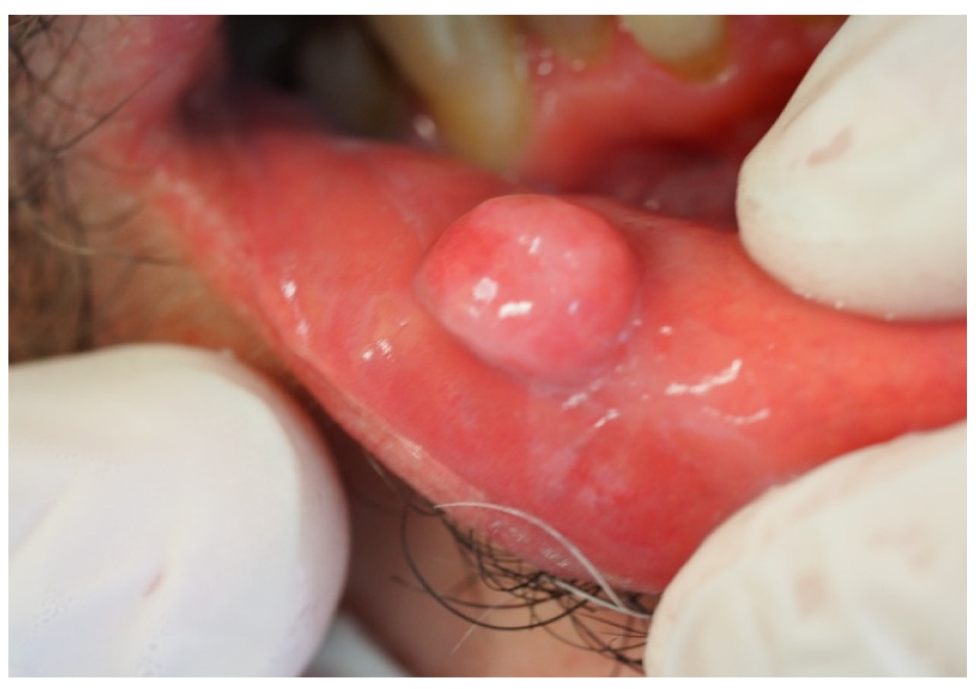 Symmetry 14 00307 g007 550