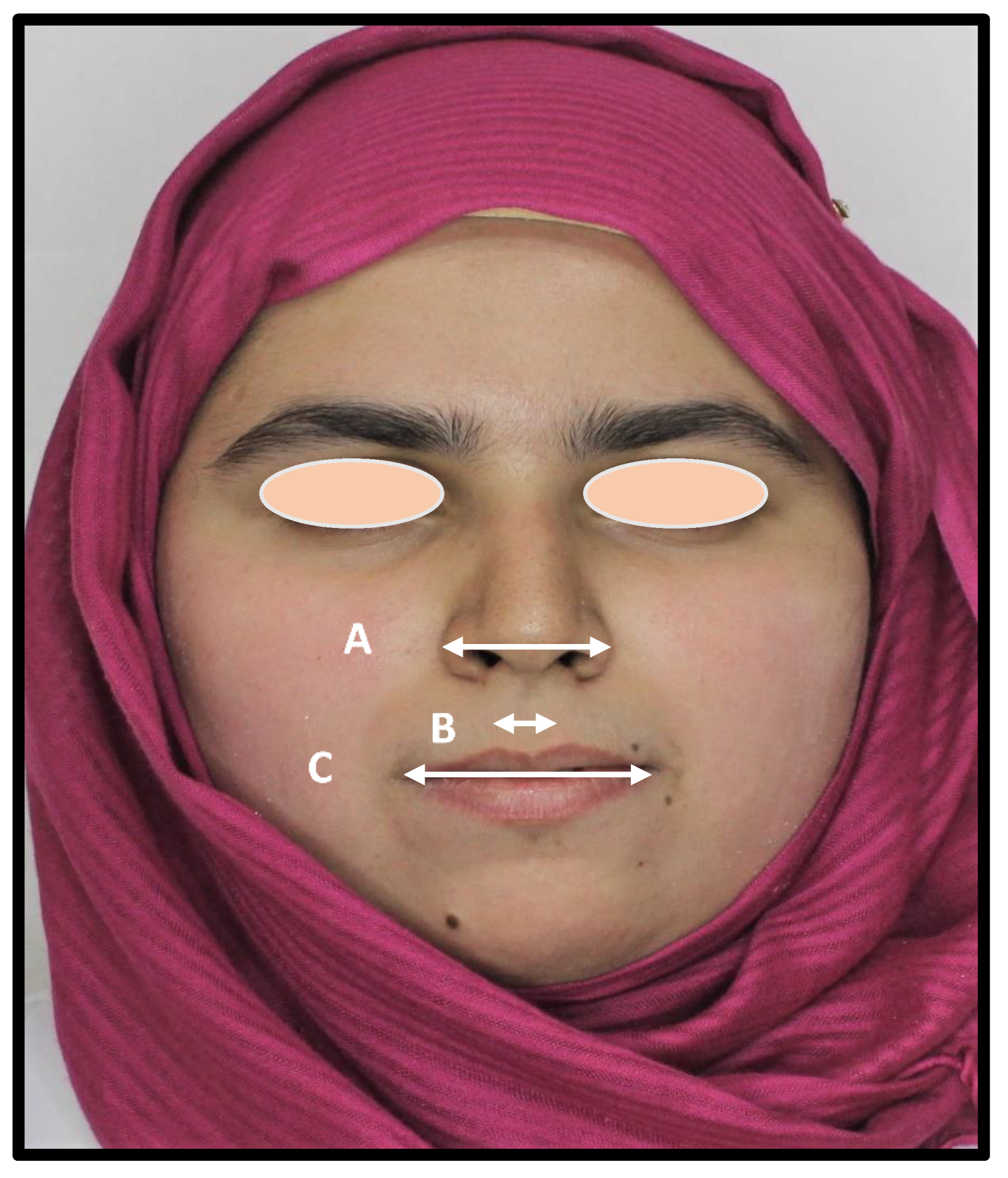 Symmetry 14 00723 g002 Symmetry 14 00723 g002