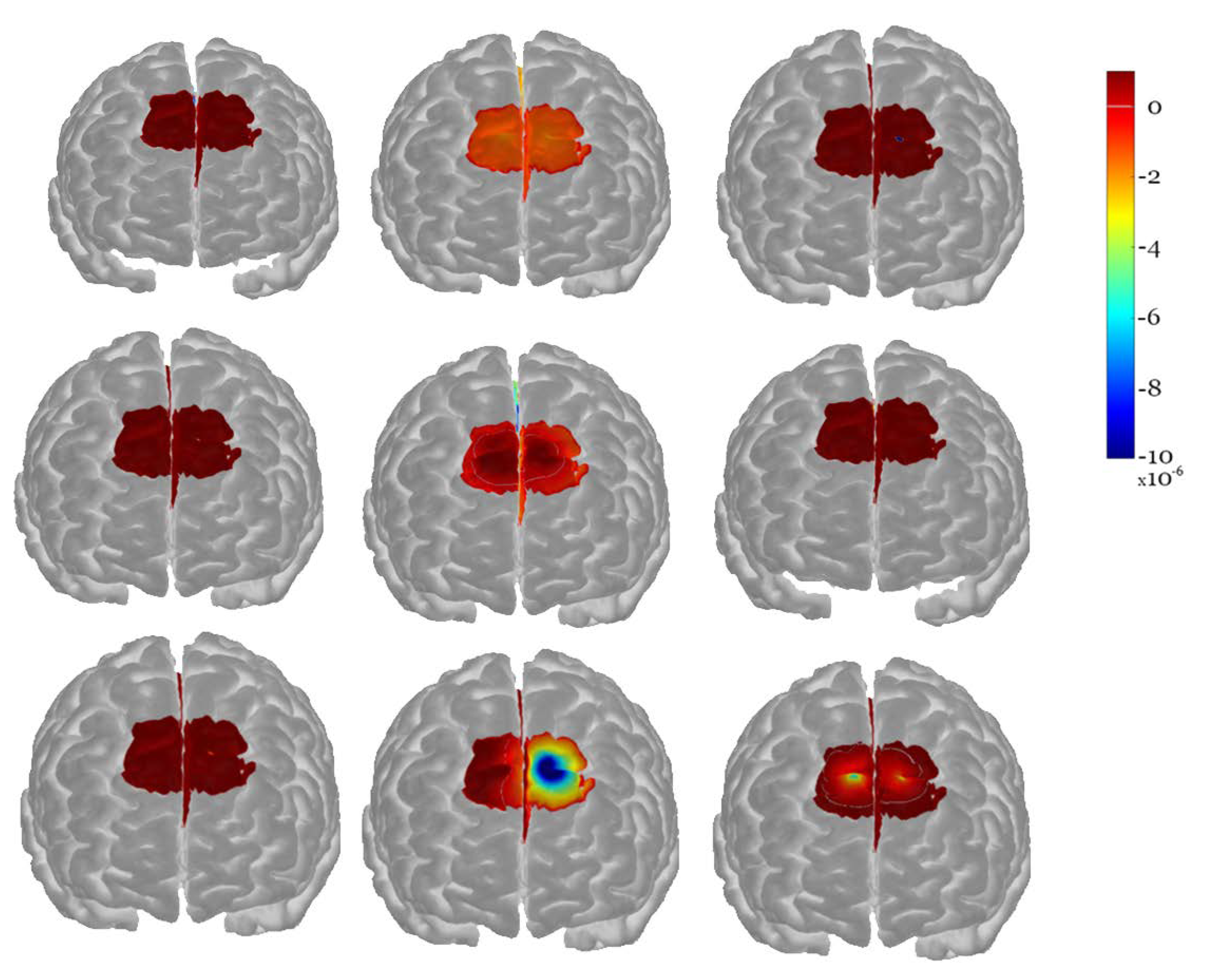 Symmetry 14 00901 g006