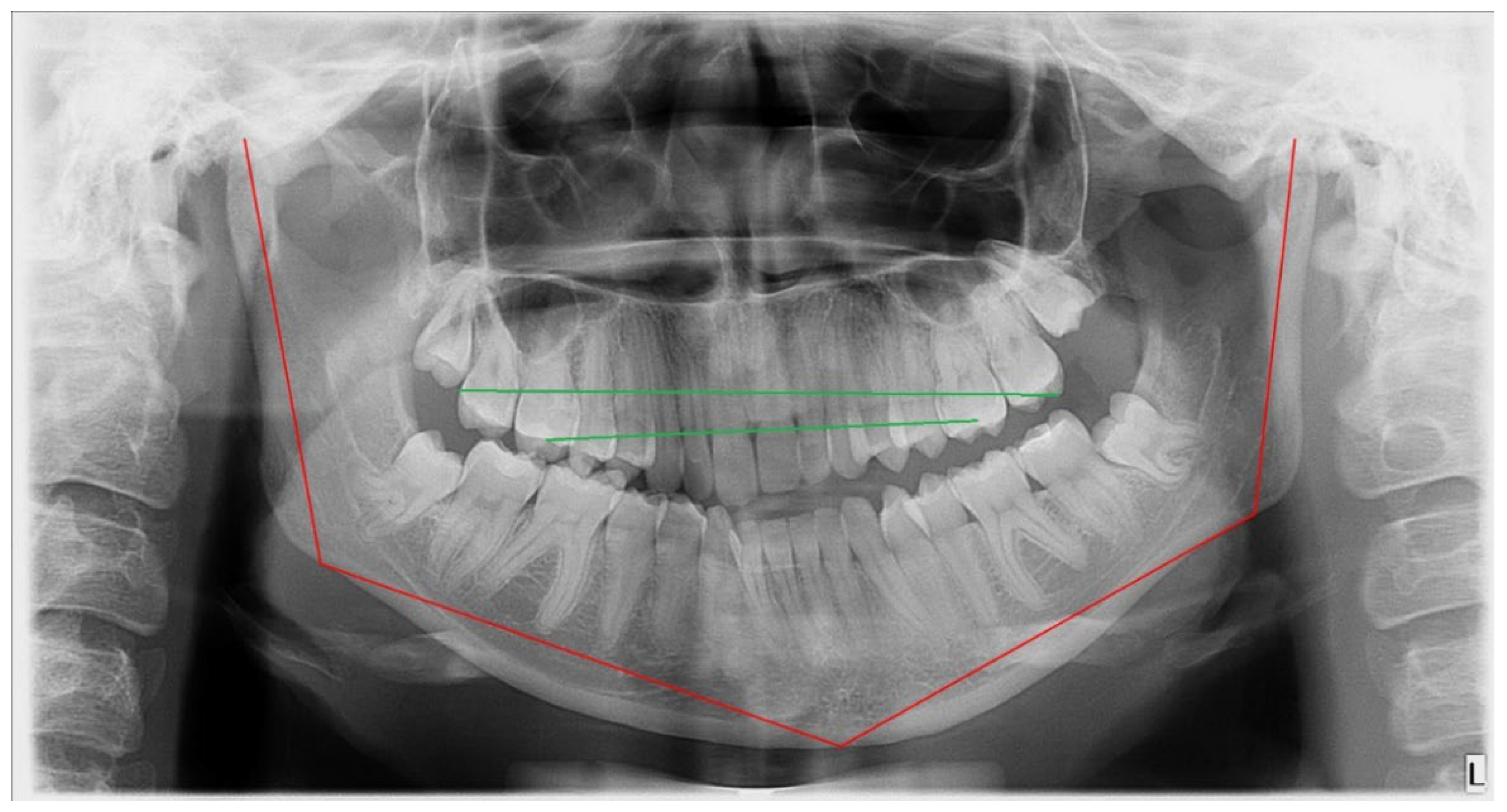 Symmetry 14 01287 g003 550