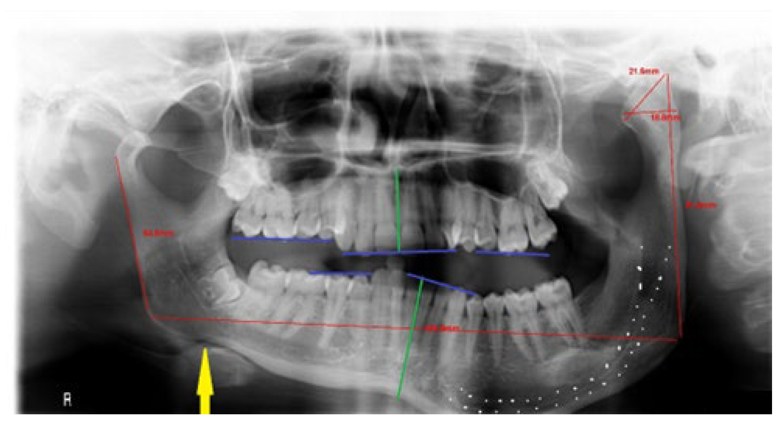Symmetry 14 01287 g005 550