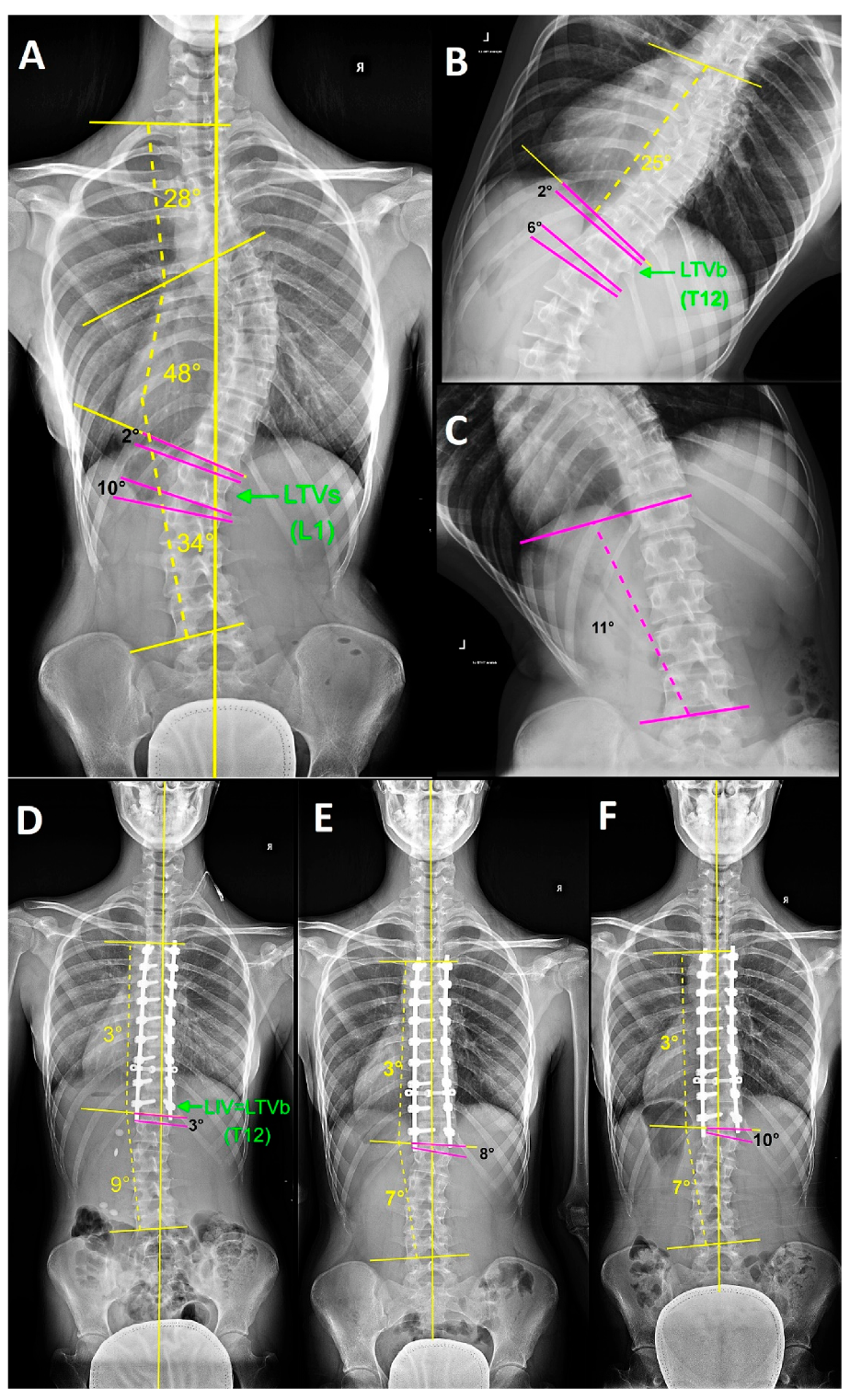 Symmetry Free FullText The Role of Bending Films in the Lowest