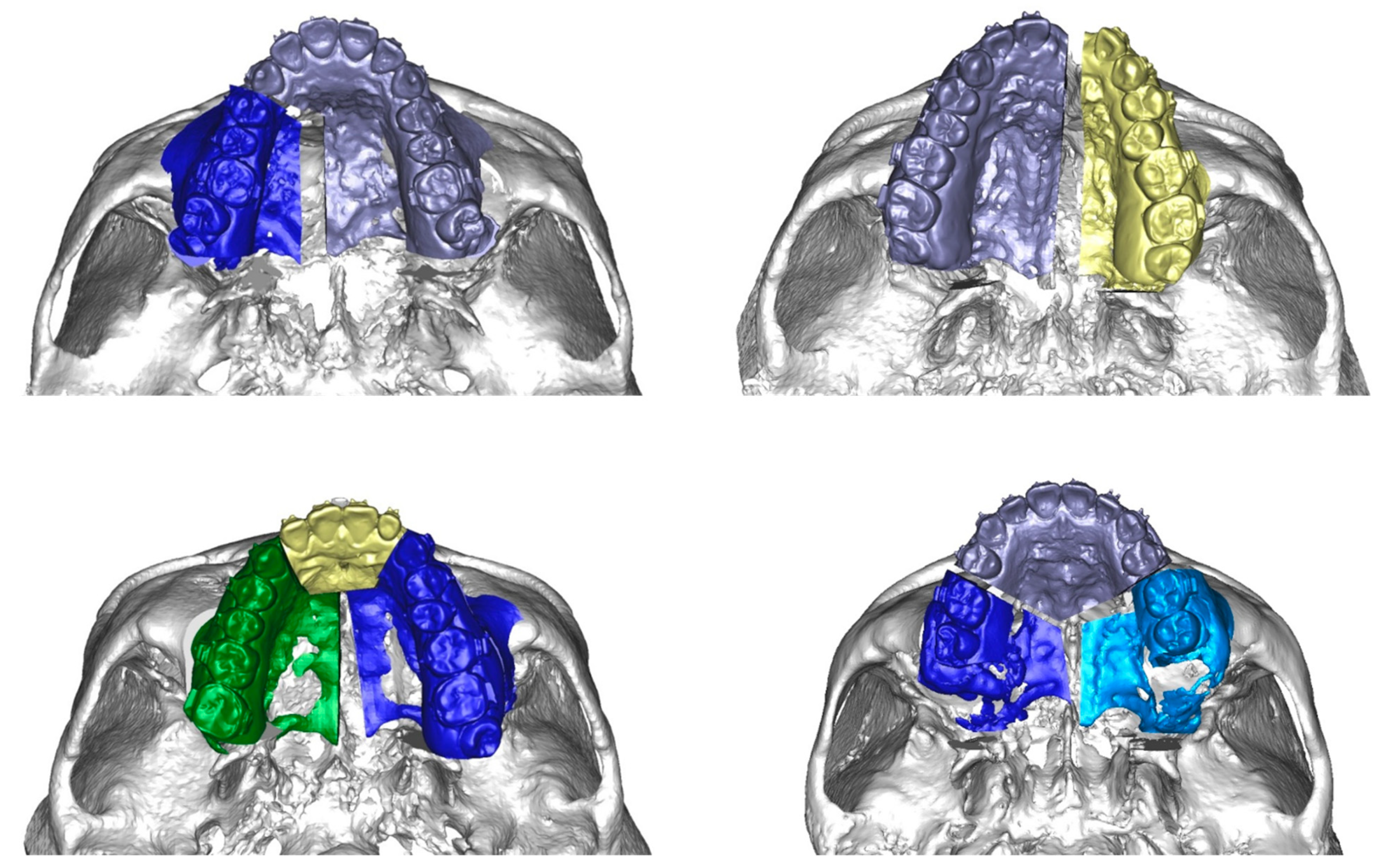 Symmetry 14 01822 g003 550