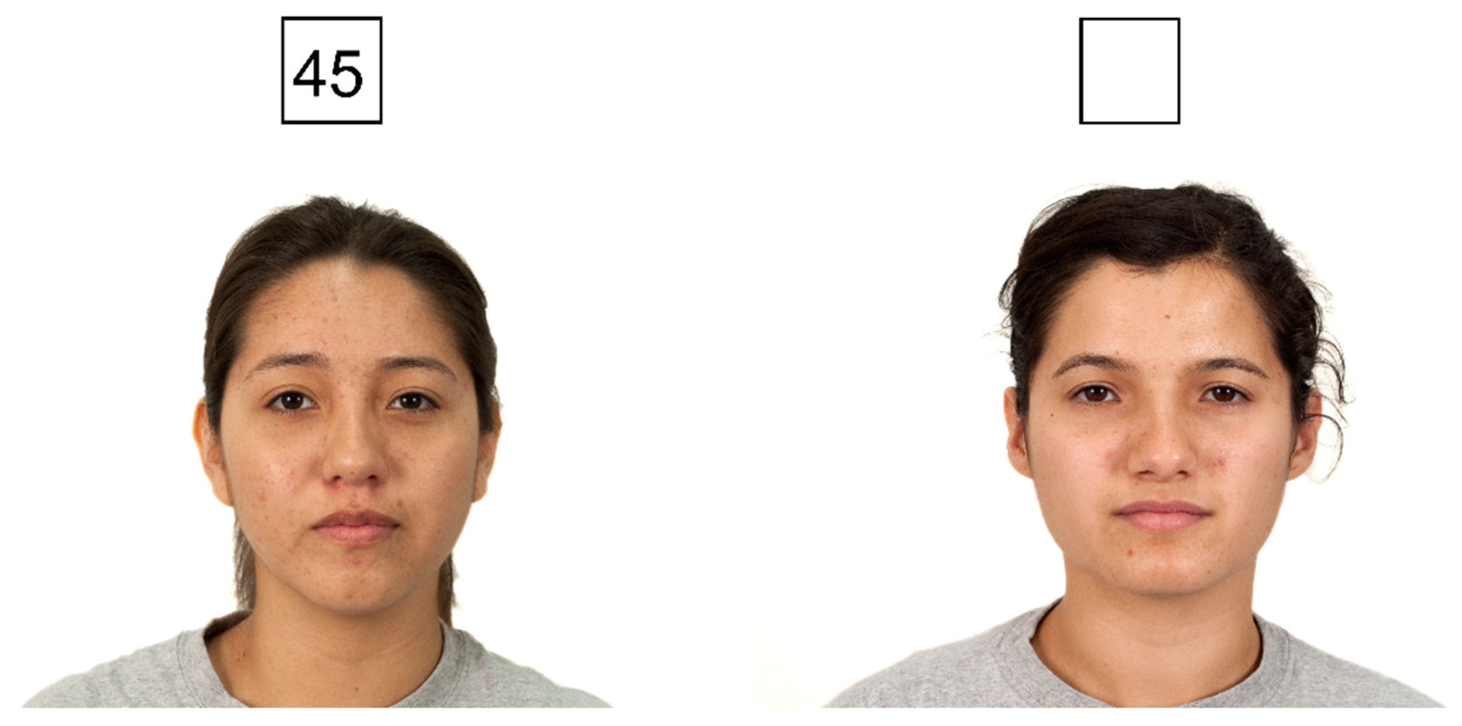 Symmetry 15 00133 g003