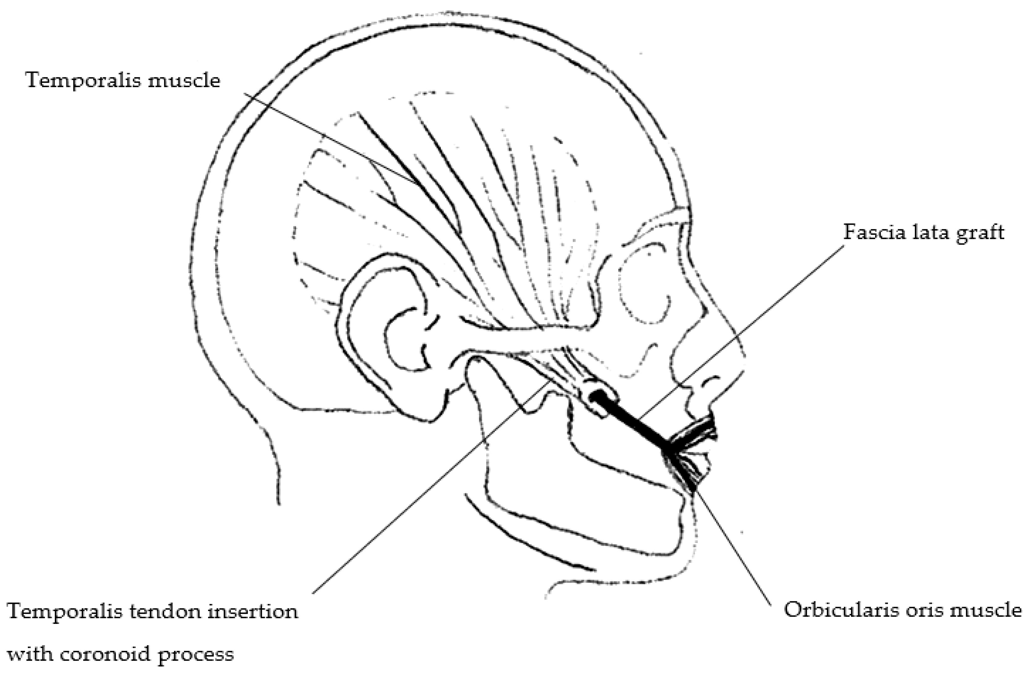Symmetry 15 00561 g001