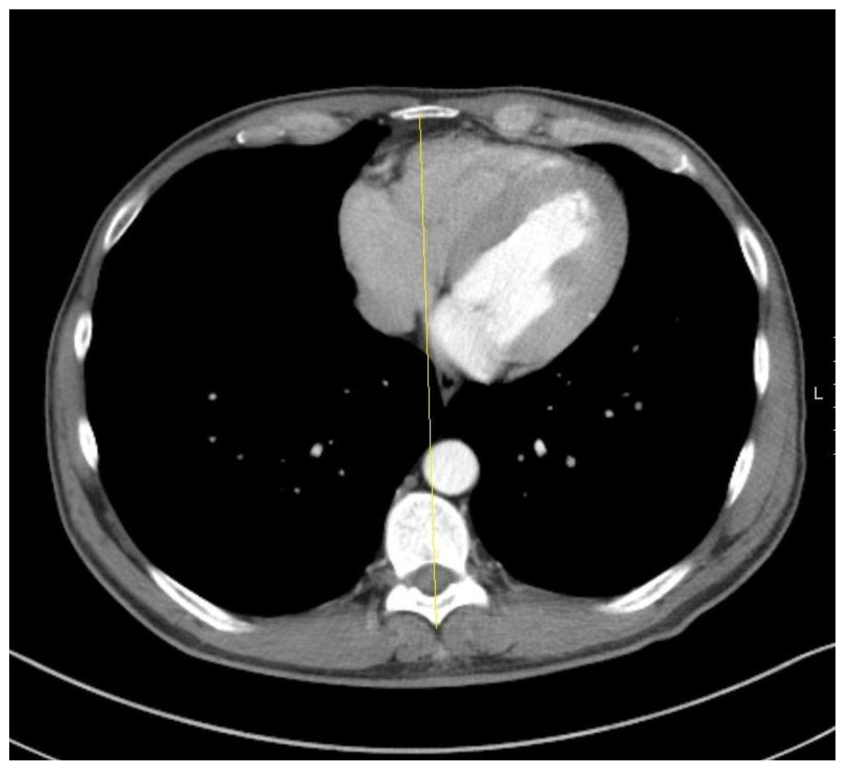 Symmetry 15 00940 g001 Symmetry 15 00940 g001
